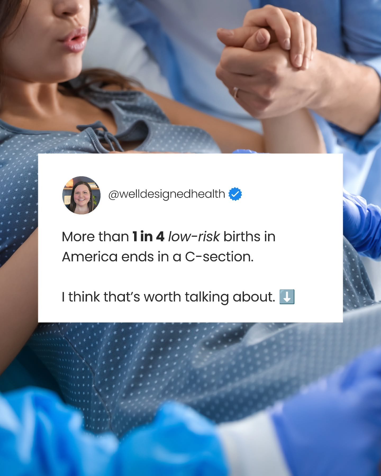 More than 1 in 4 low-risk births in America ends in a C-section.

And overall? Nearly 1 in 3 U.S. births are now delivered by C-section. In 2024, the rate was 32.4%.

It wasn&rsquo;t always this common.....
In 1996, about 1 in 5 births (20.7%) were C