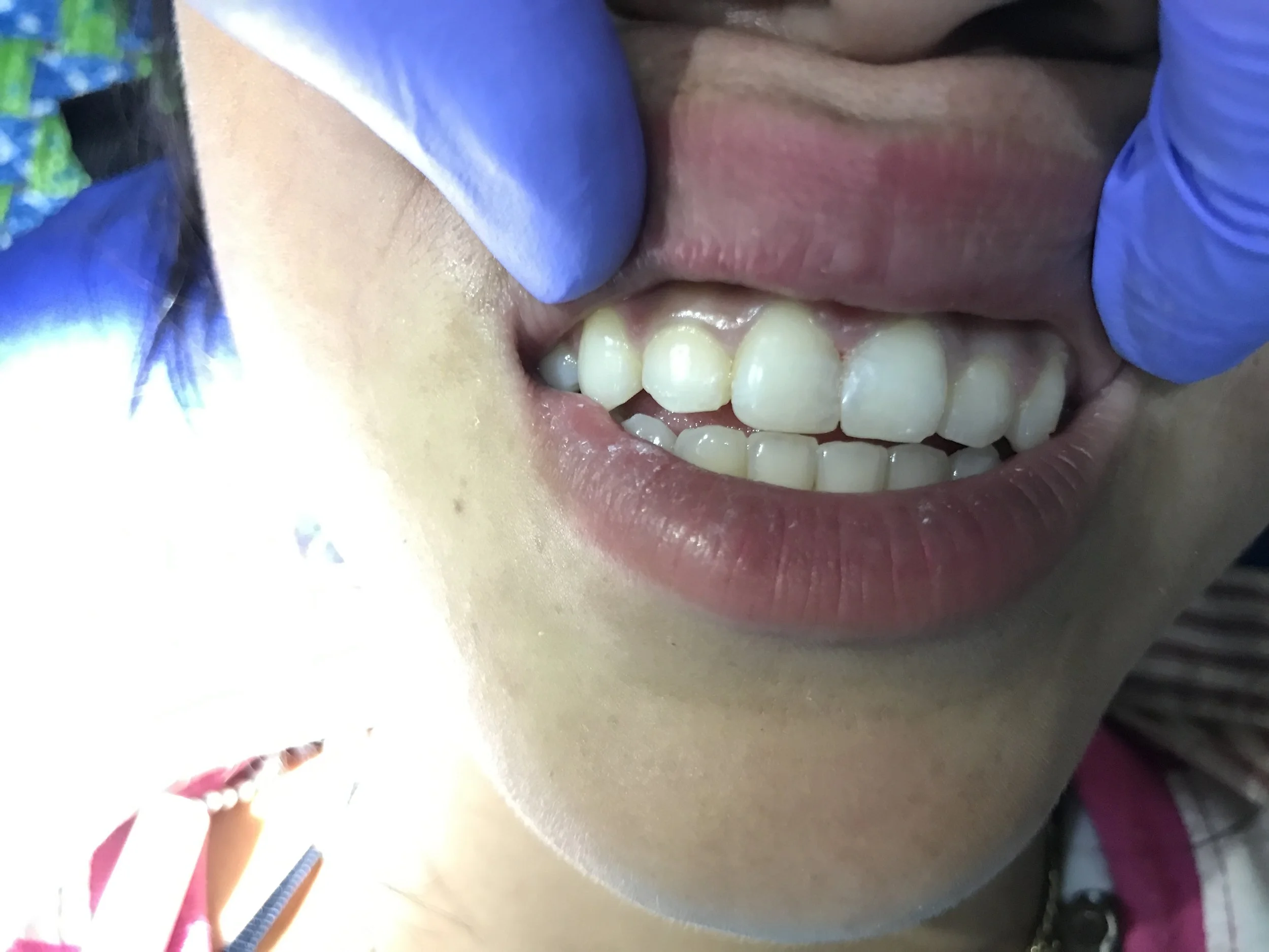Cambodia 2021 case 1 after.JPG