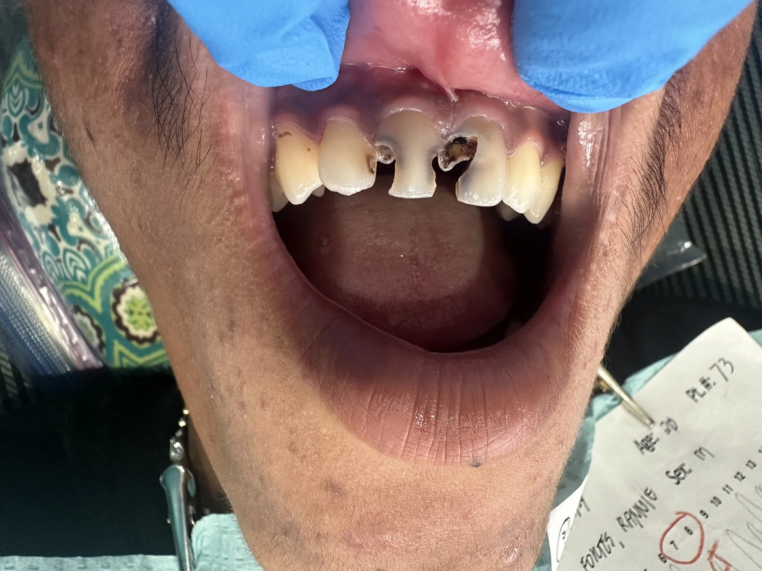 Philippines 2024 Case 3 before.jpeg