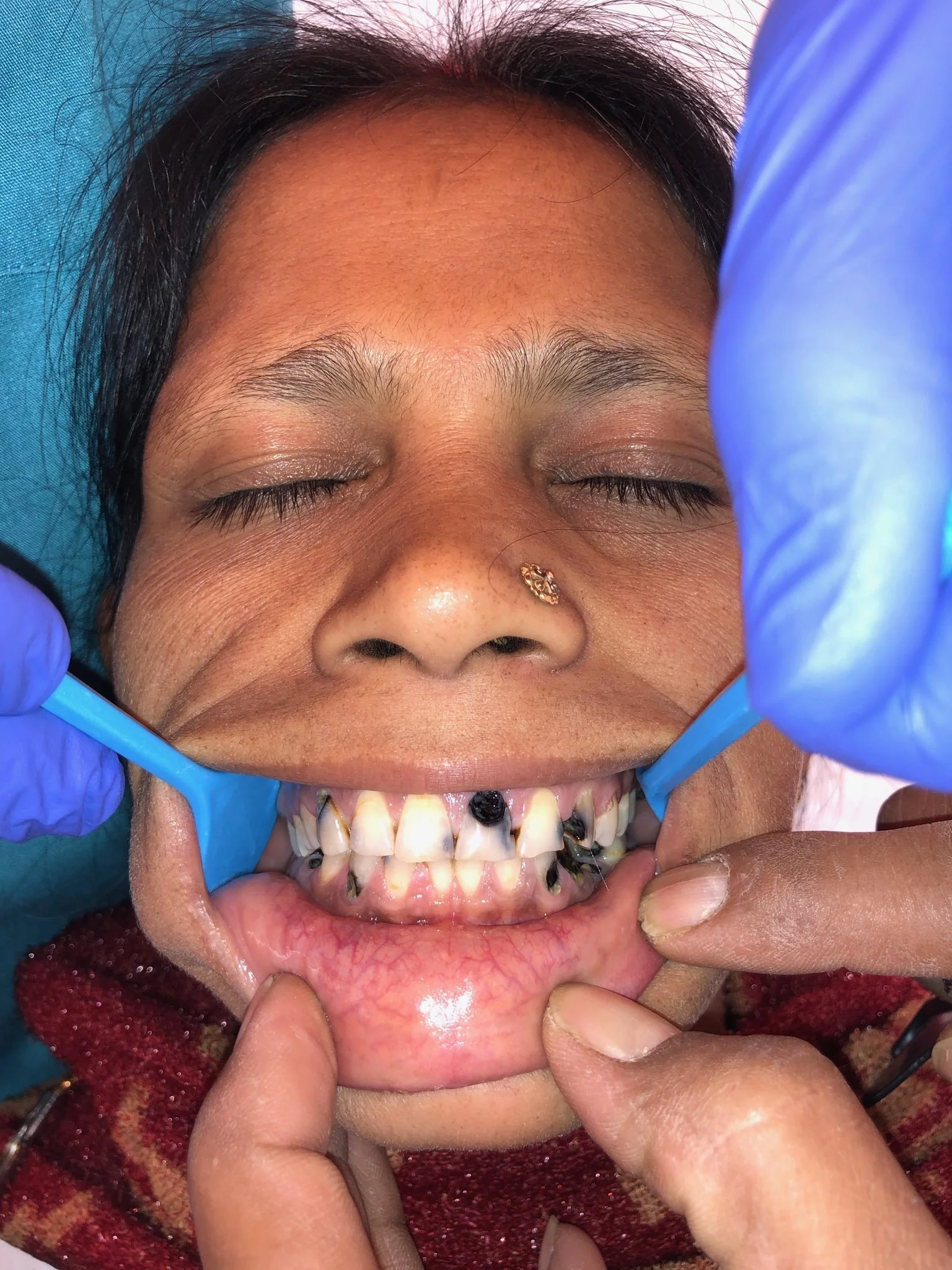 India 2019 case 1 before.JPG