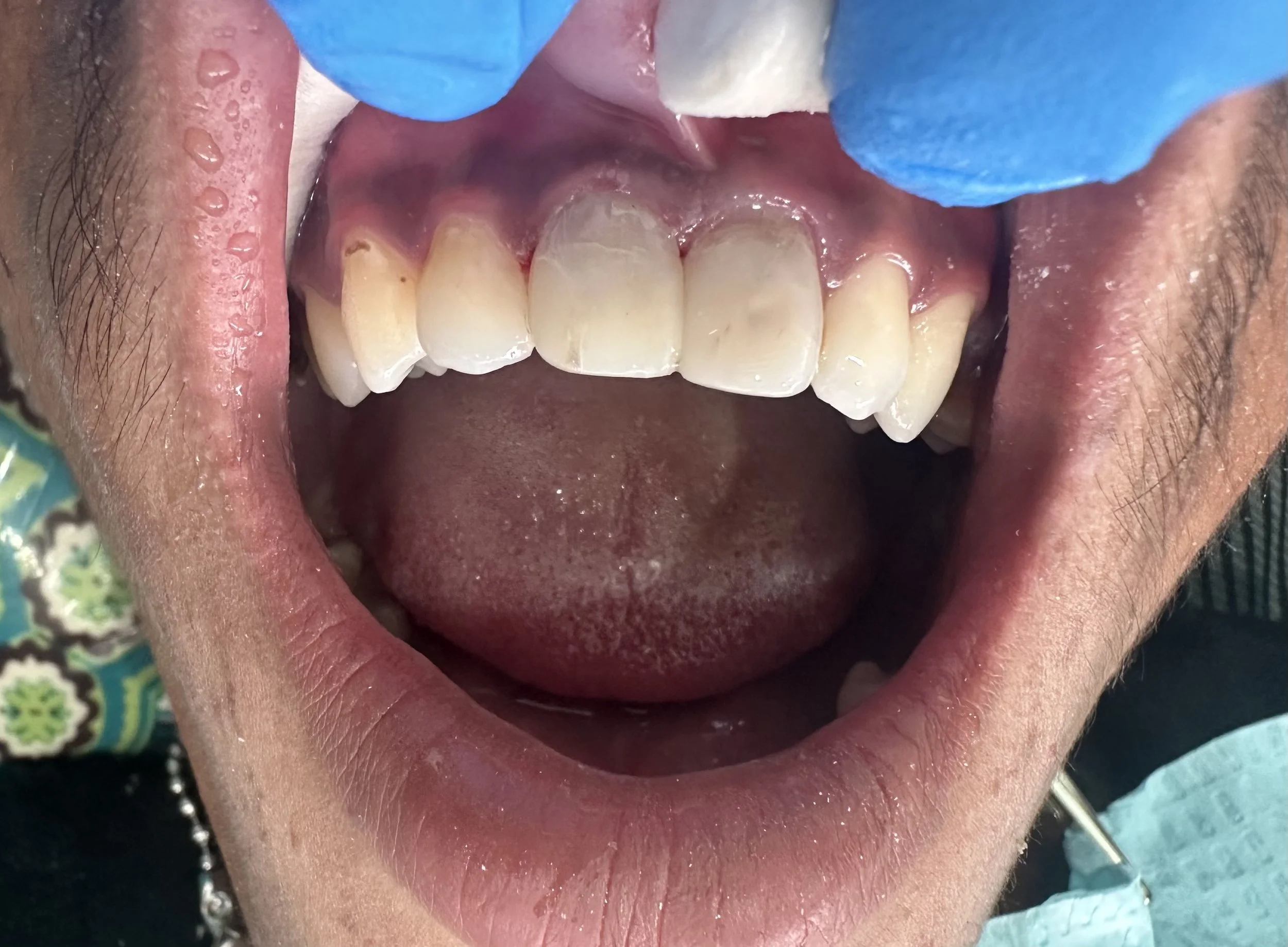 Philippines 2024 Case Study 1 After.jpeg