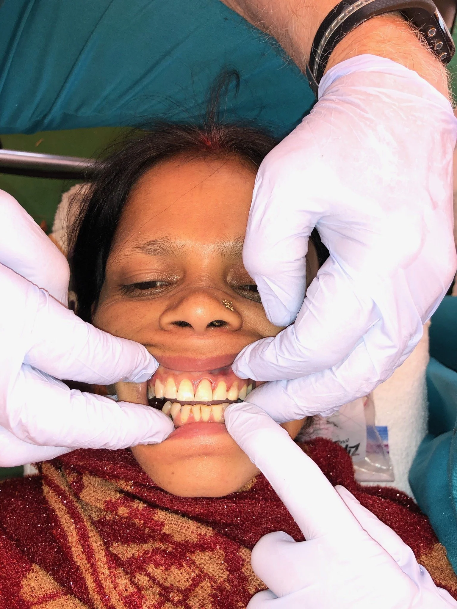 India 2019 case 1 after.JPG