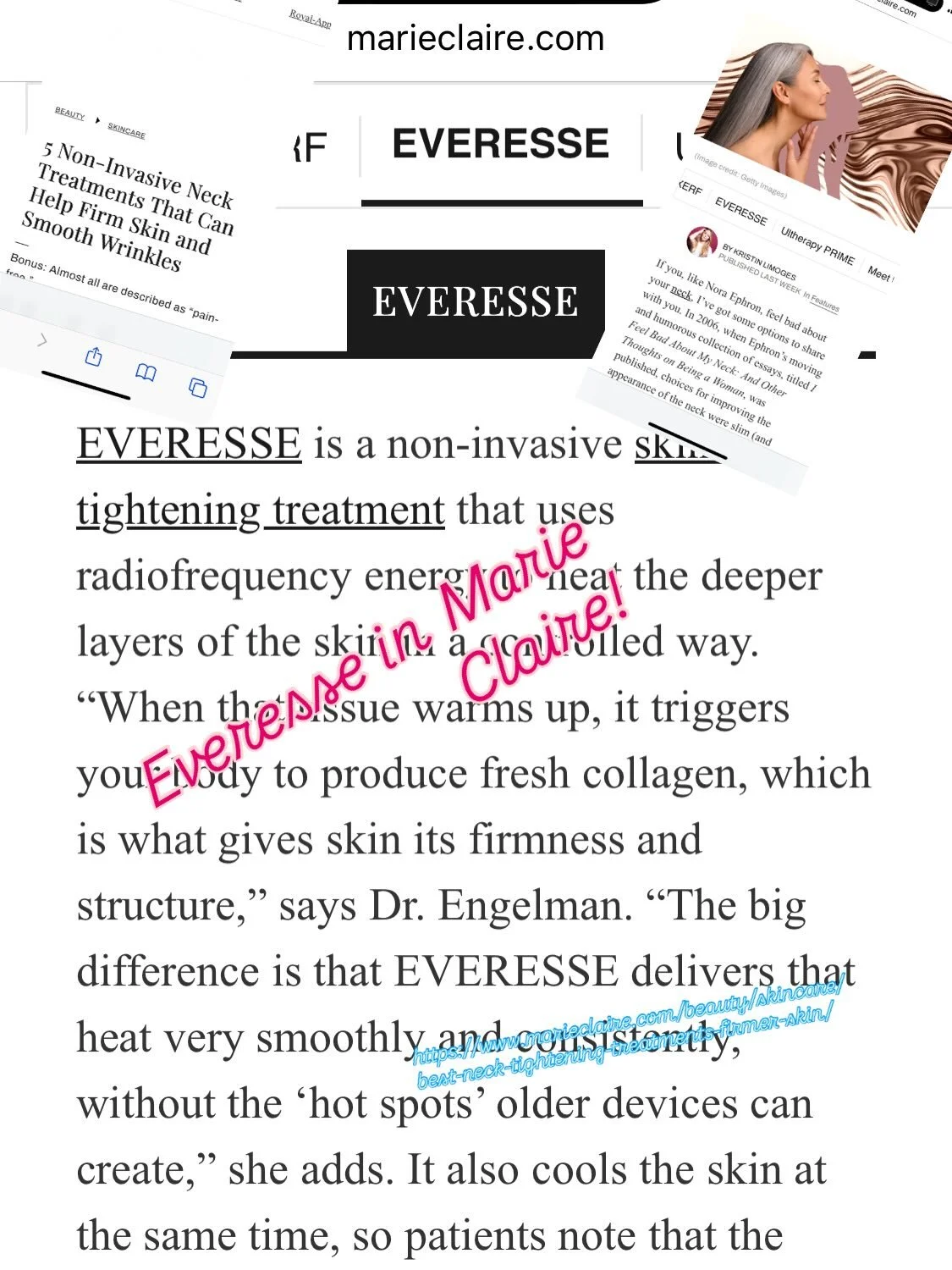 ✨ Everesse was just featured in Marie Claire&hellip; and now it&rsquo;s here at ZH Aesthetic Medicine!
They highlighted it for its strong tightening effect and how beautifully it works for the neck area &mdash; one of the first places we notice aging