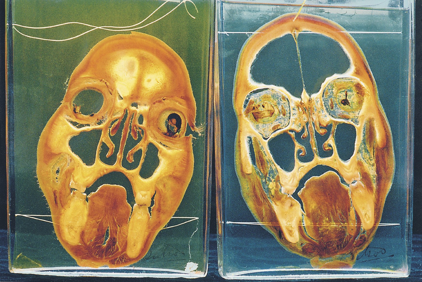 Mütter Museum: Photographs