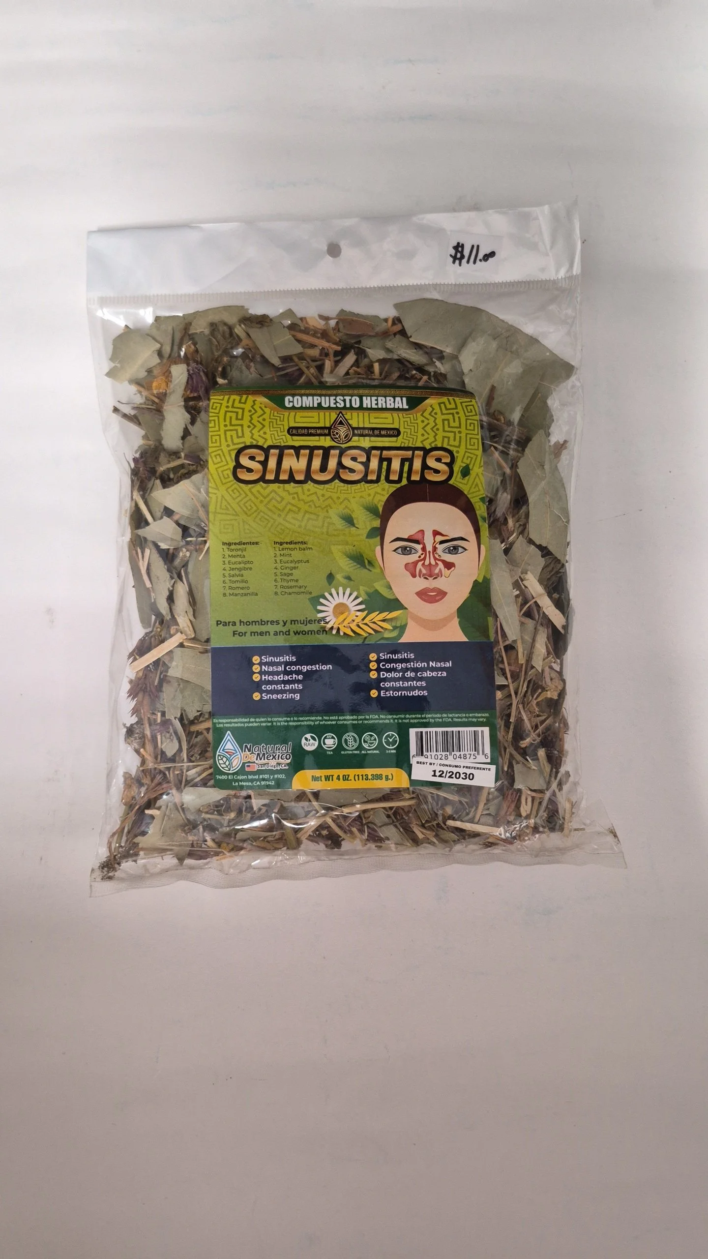 Sinusitis
