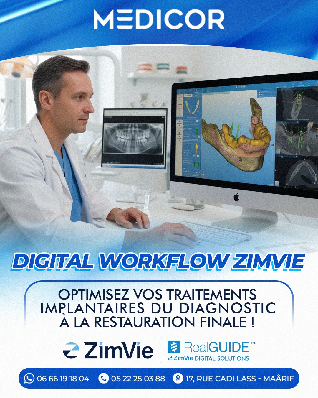 🦷 Découvrez le Digital Workflow ZimVie : La révolution implanto-prothétique
