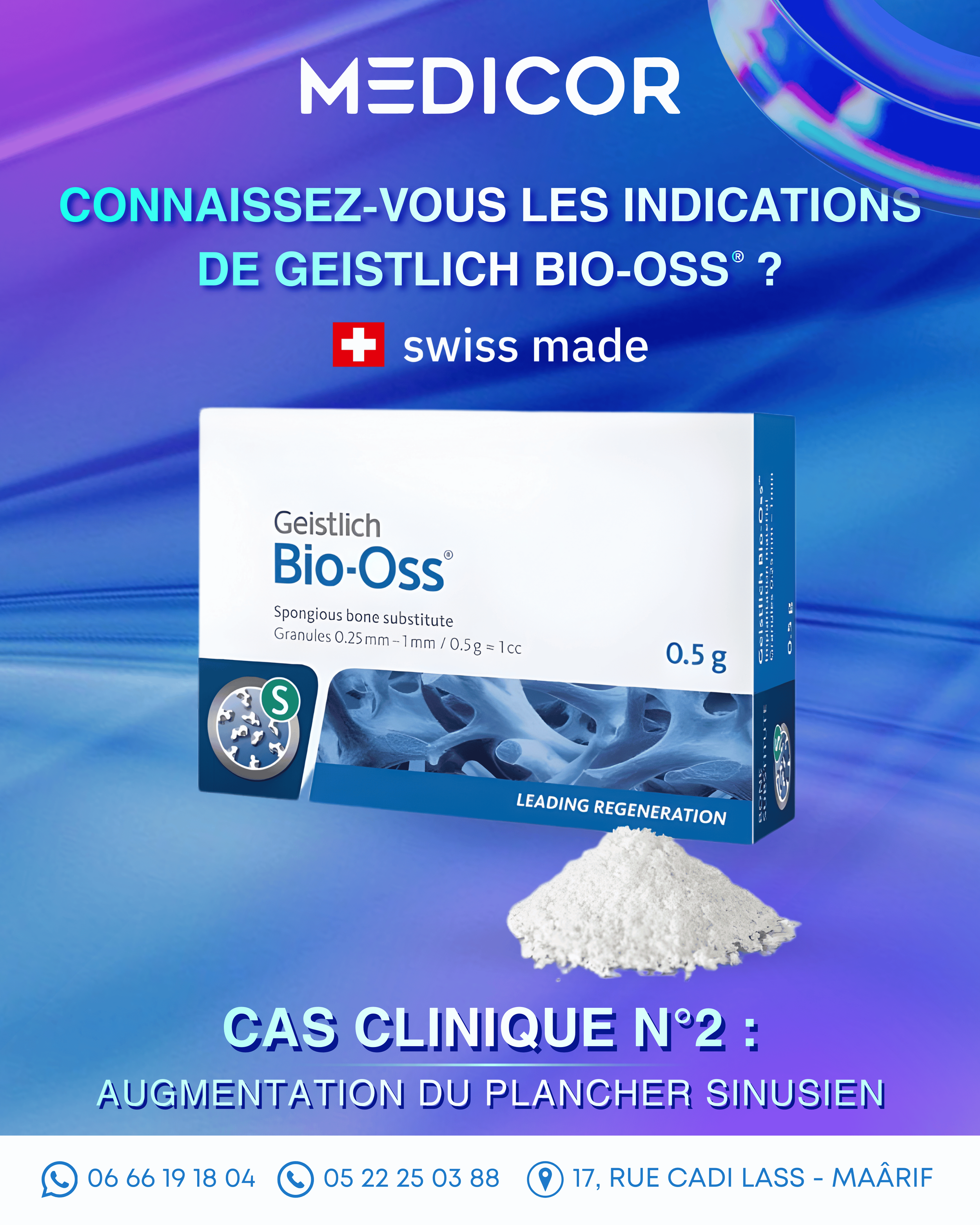 Connaissez-vous les indications de Geistlich Bio-Oss® ? Cas clinique N°2 : Augmentation du plancher sinusien