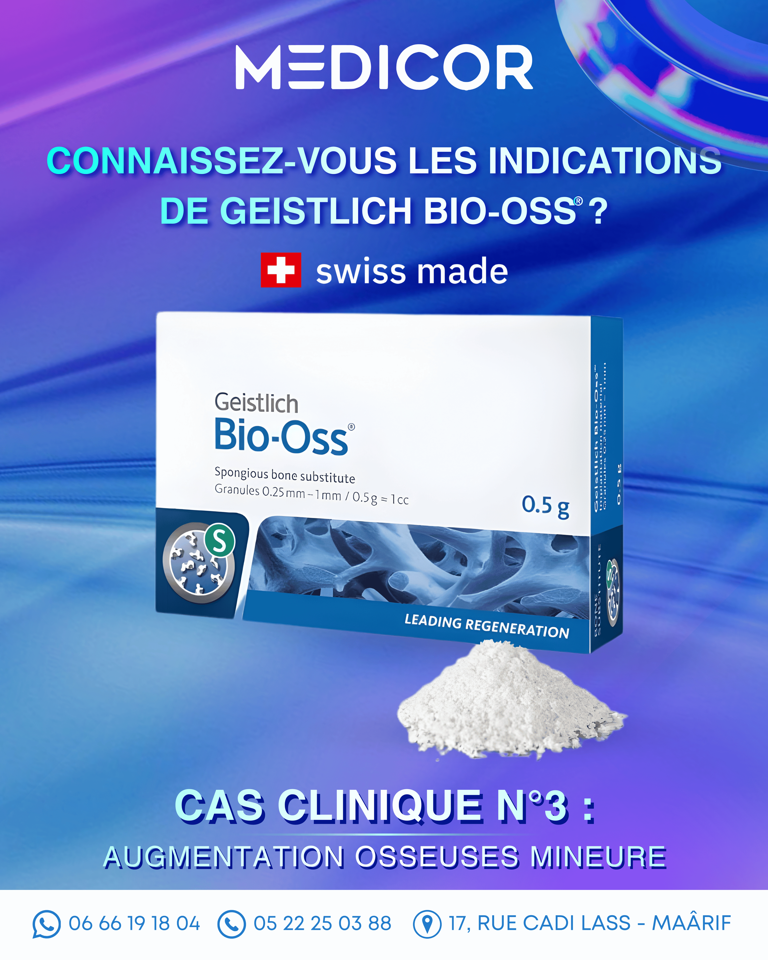 Connaissez-vous les indications de Geistlich Bio-Oss® ? Cas clinique N°3 : Augmentation osseuses mineure