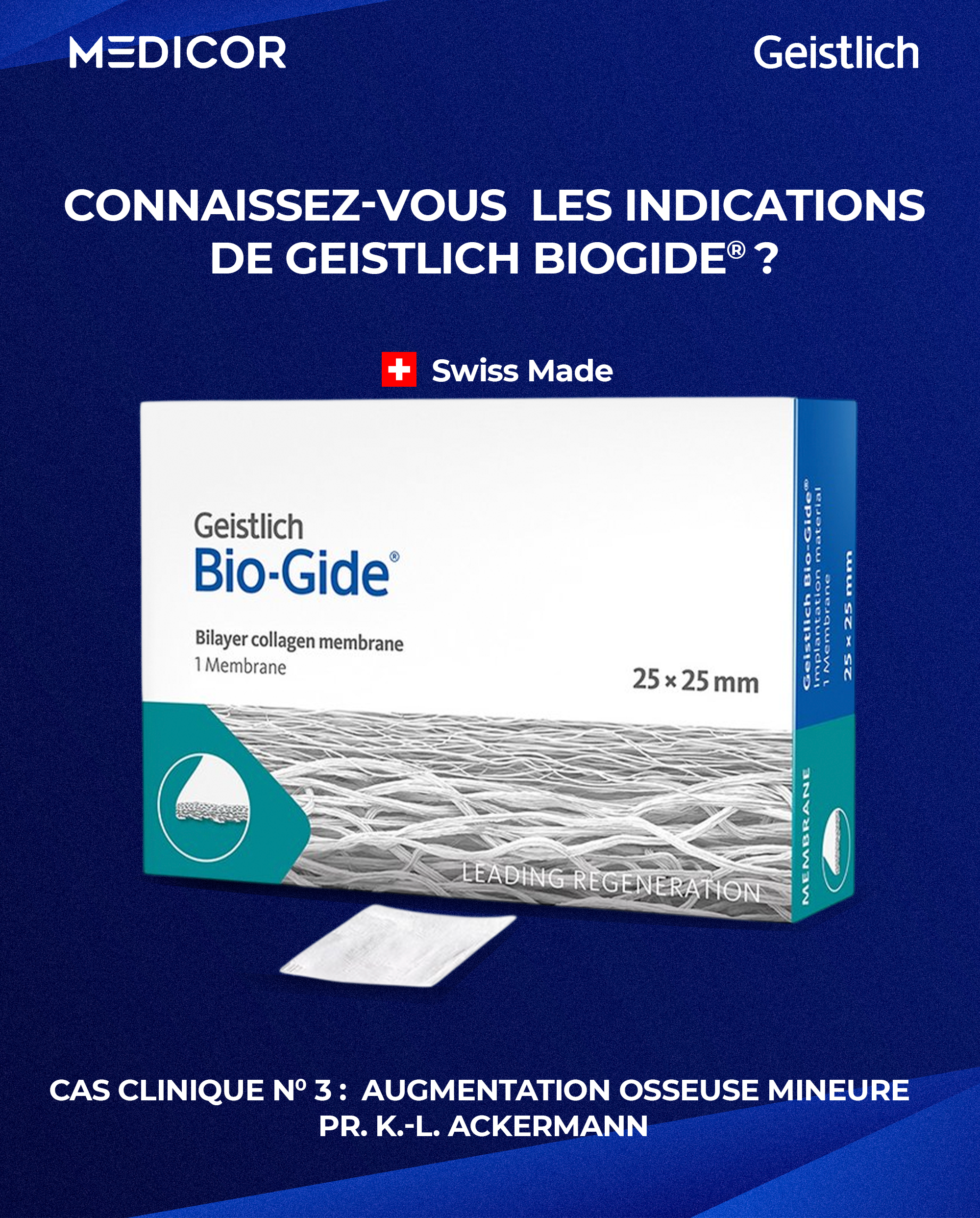 🦷  Connaissez-vous les indications de Geistlich Bio-Gide® ?