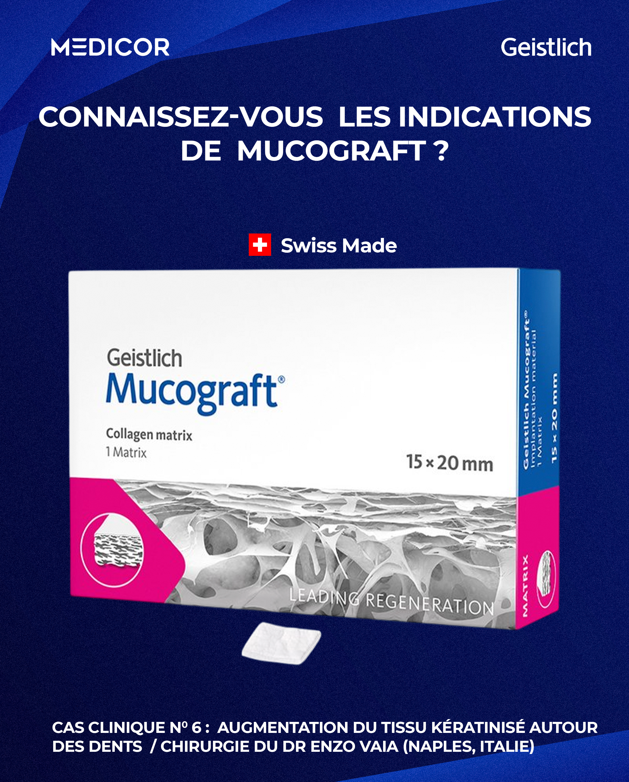 𝐂𝐎𝐍𝐍𝐀𝐈𝐒𝐒𝐄𝐙-𝐕𝐎𝐔𝐒 𝐋𝐄𝐒 𝐈𝐍𝐃𝐈𝐂𝐀𝐓𝐈𝐎𝐍𝐒 𝐃𝐄 MUCOGRAFT ?