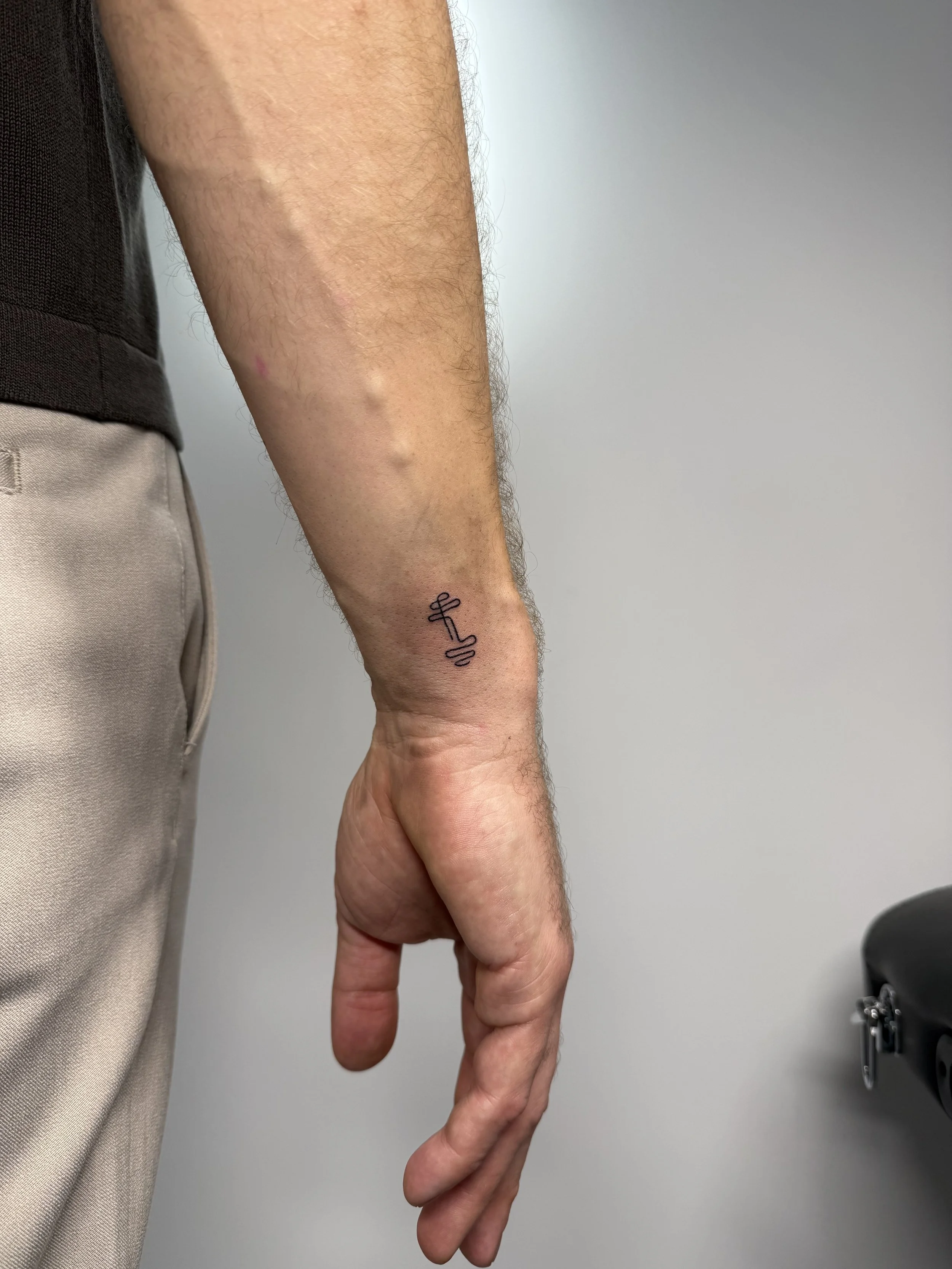 De afbeelding toont een close-up van een hand en onderarm, met een klein tatoeage en enkele lichte rode vlekken op de huid.