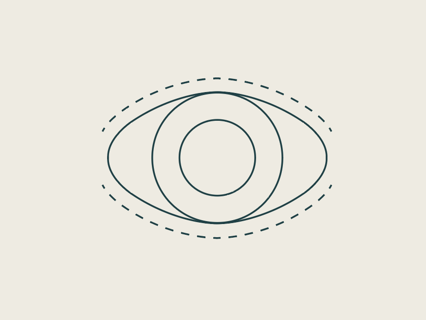 Blepharoplasty