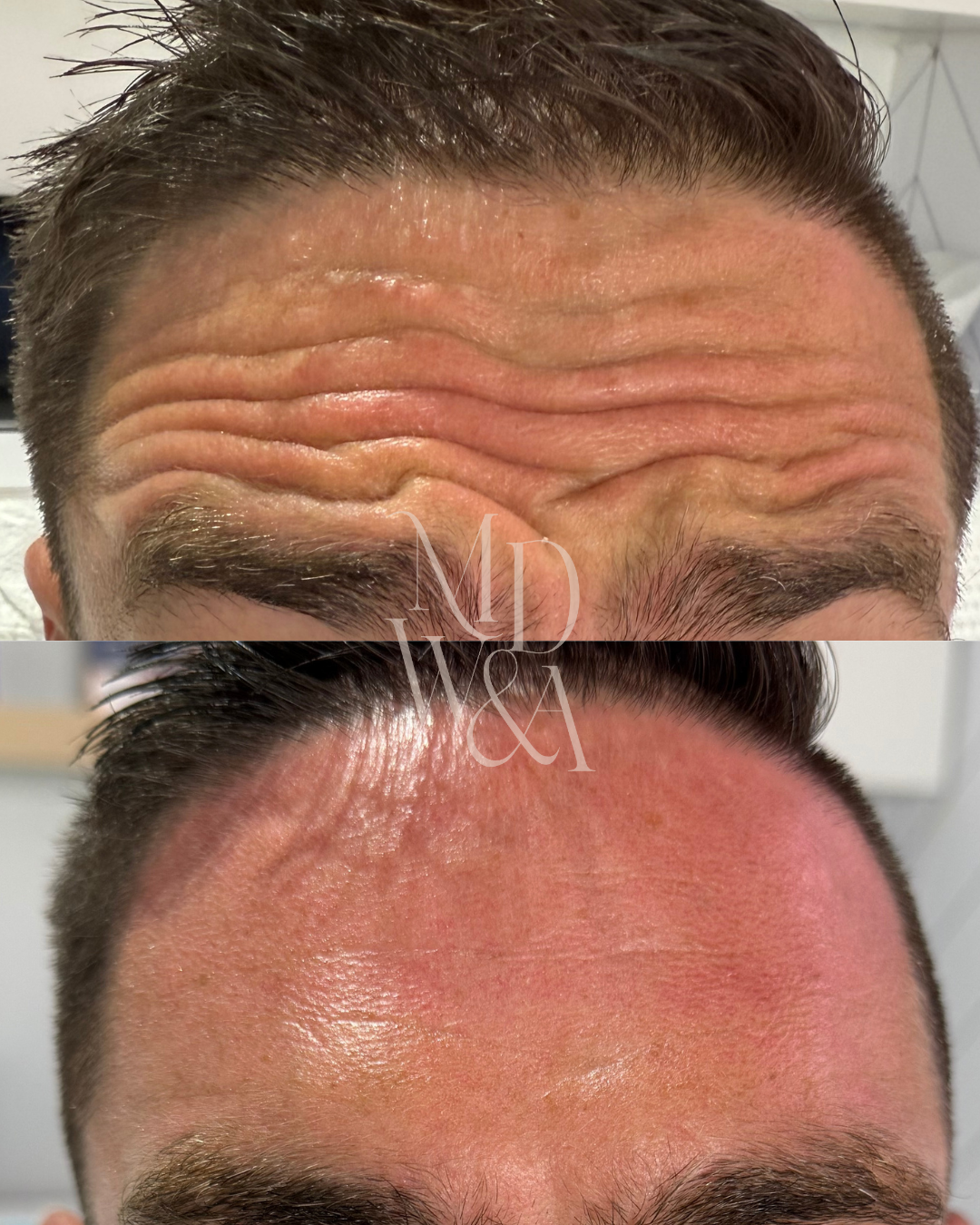 mike before:after 1.png