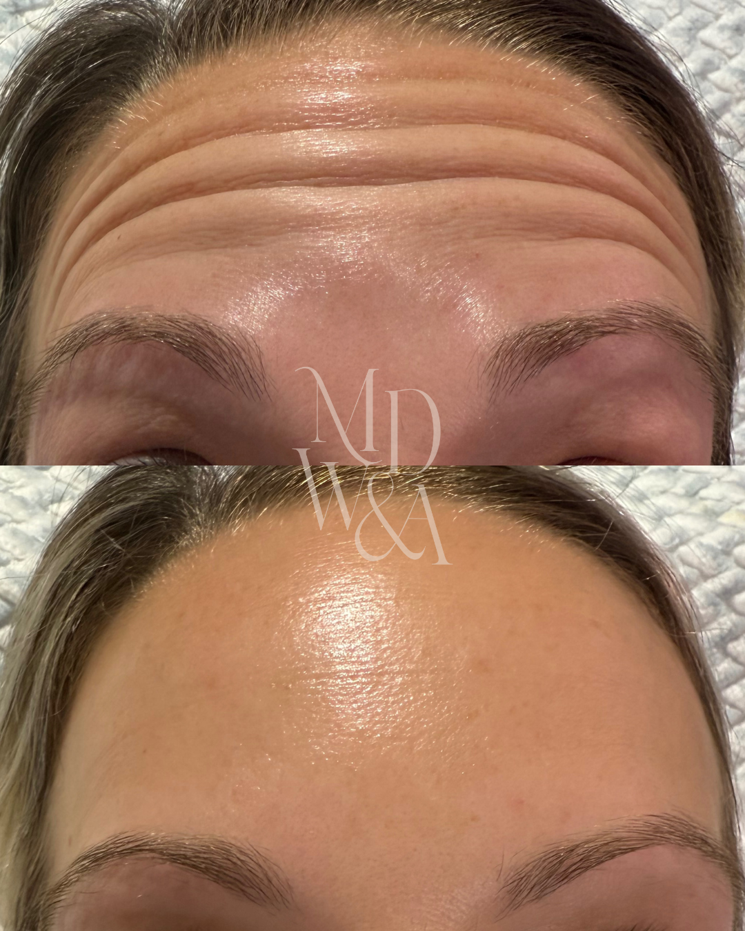 chelsea before:after .png