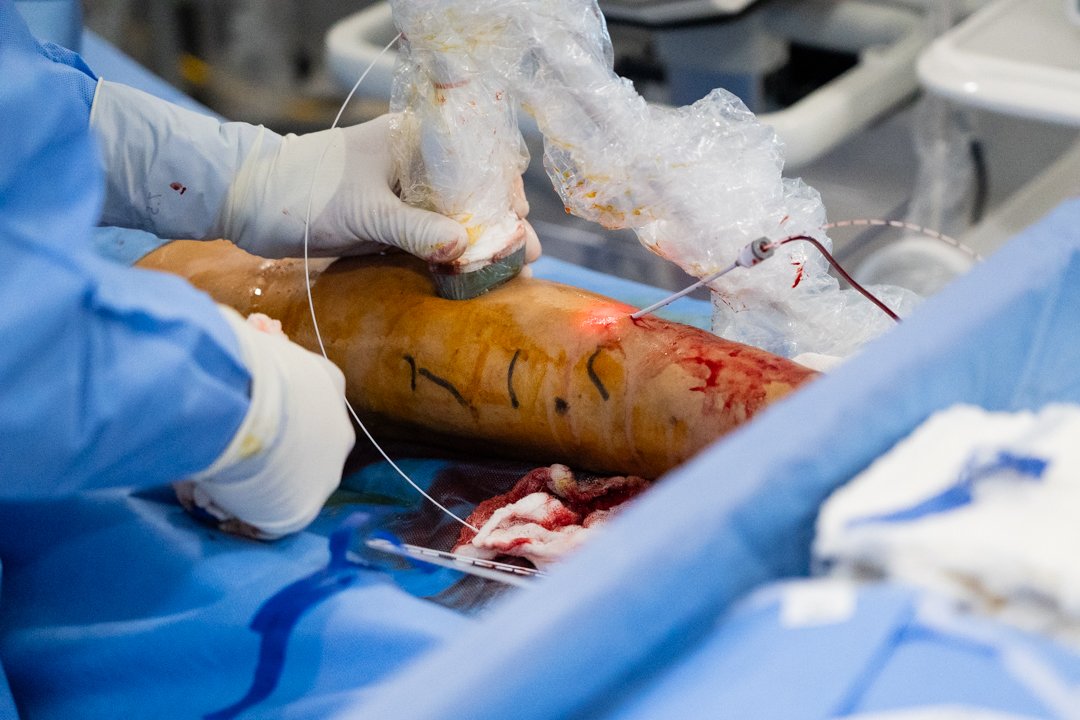 cirugia-varices-cimasalud-08.jpg