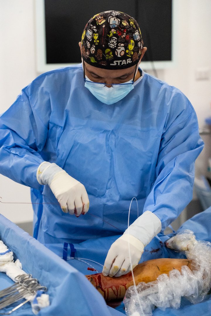 cirugia-varices-cimasalud-03.jpg