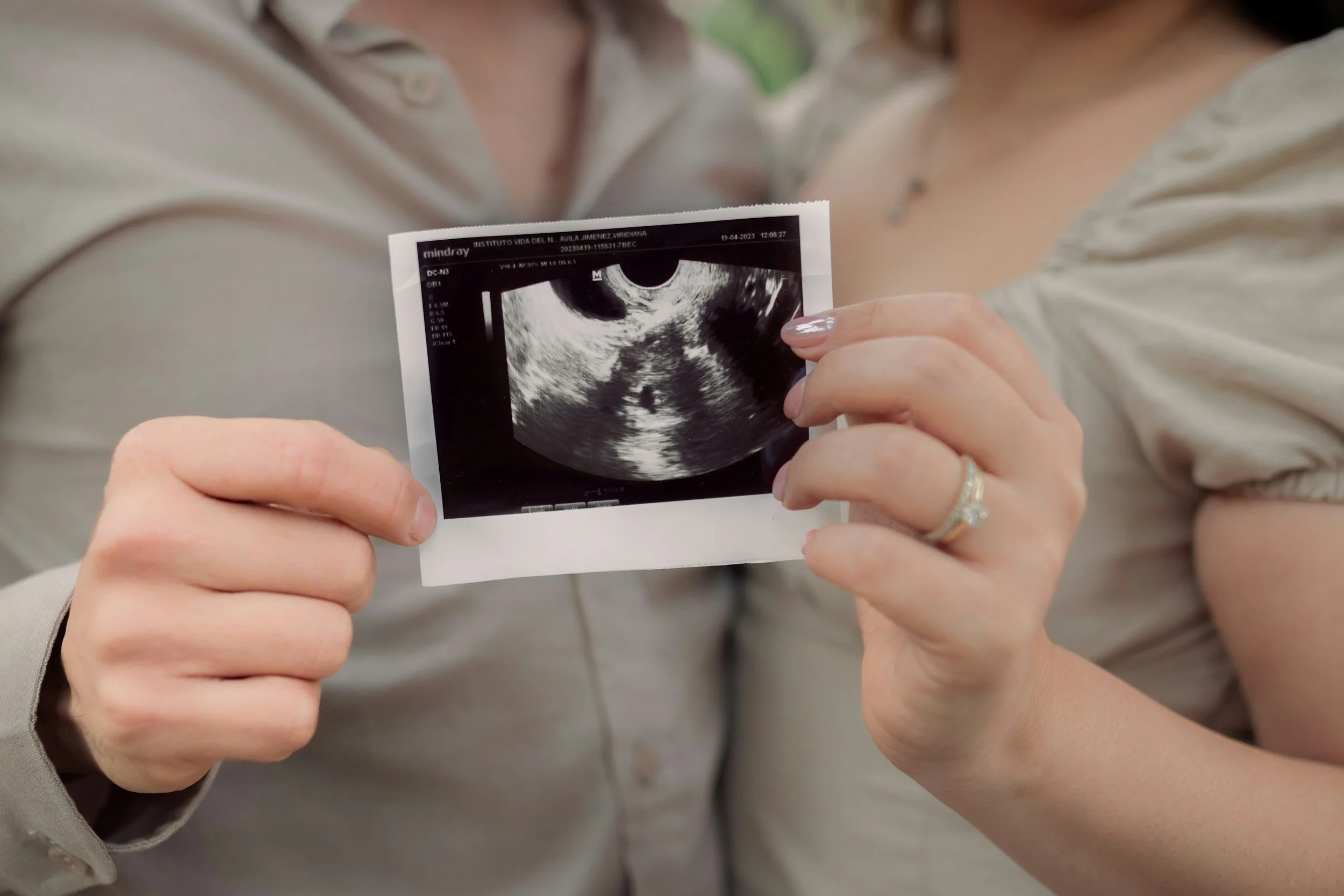 couple holding an ultrasound image of successful pregnancy at Hannam Fertility Centre