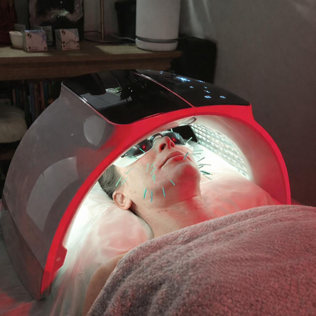 Facial Rejuvenation Acupuncture Los Angeles