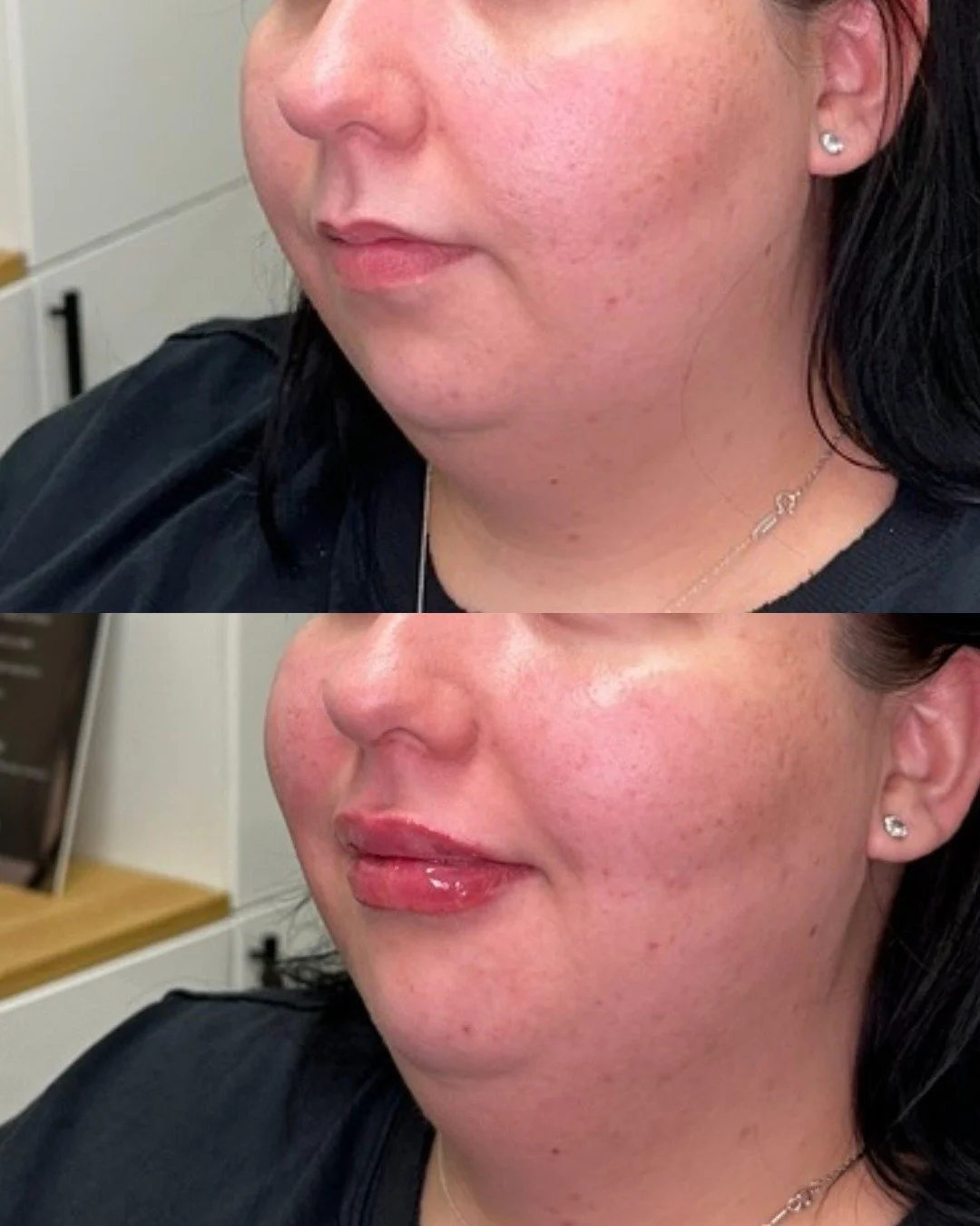 A pillowy pout you&rsquo;ll love 💋

This before &amp; after shows how we can enhance volume, restore hydration, and create a gorgeous, soft contour &mdash; no filter necessary.

Come get transformed (in the best way possible 🤩) with Glow Lab

📞480