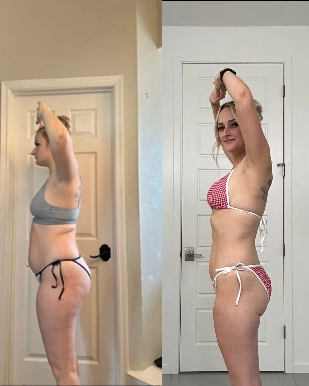 Transformation Tuesday: Weightloss 🤩

This patient has been seeing us for 6-7 months on our Tirzepatide membership! She is currently maintaining with diet/exercise and seeing us for maintenance syringes!

Want to get your weightless journey started?