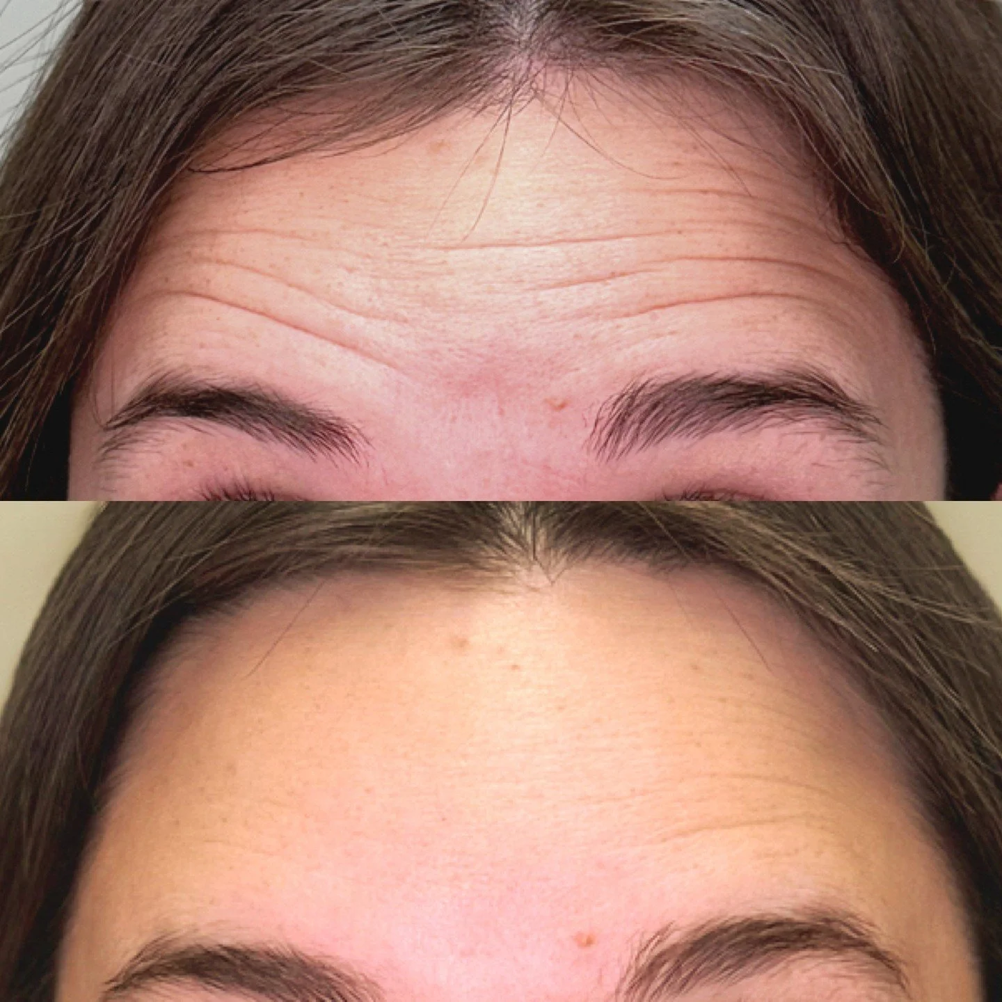 We love our neurotoxins! 

We have tons of options for our clients such as Botox, Dysport and Jeuveau 💉

Don't forget about our new Tox membership:

$50/month for discounted botox, call us to get your botox scheduled before the holidays! 480-771-720