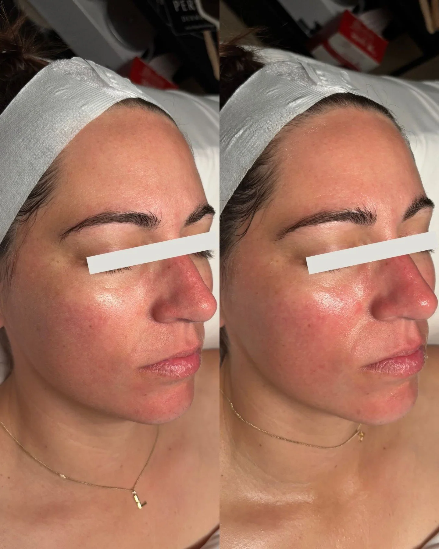 Glowing skin is always in ✨

Before the facial, this client came in dehydrated, needing moisture. She left with some new home care and hydrated!

Come and get a facial with our aesthetician, who now has Tuesday evening appointment options! 

📞480-77