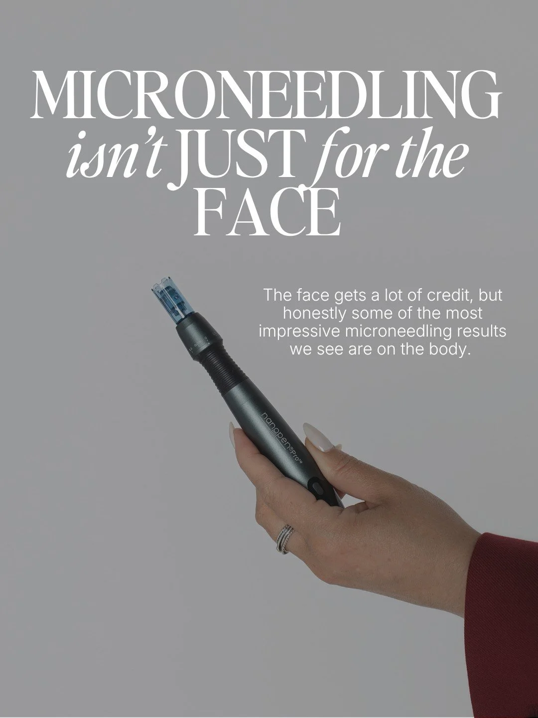 Let's talk about microneedling for the body for a second because I feel like it is one of the most underrated conversations in aesthetics right now. 

Everyone knows microneedling for the face. But the same treatment works just as well on areas most 