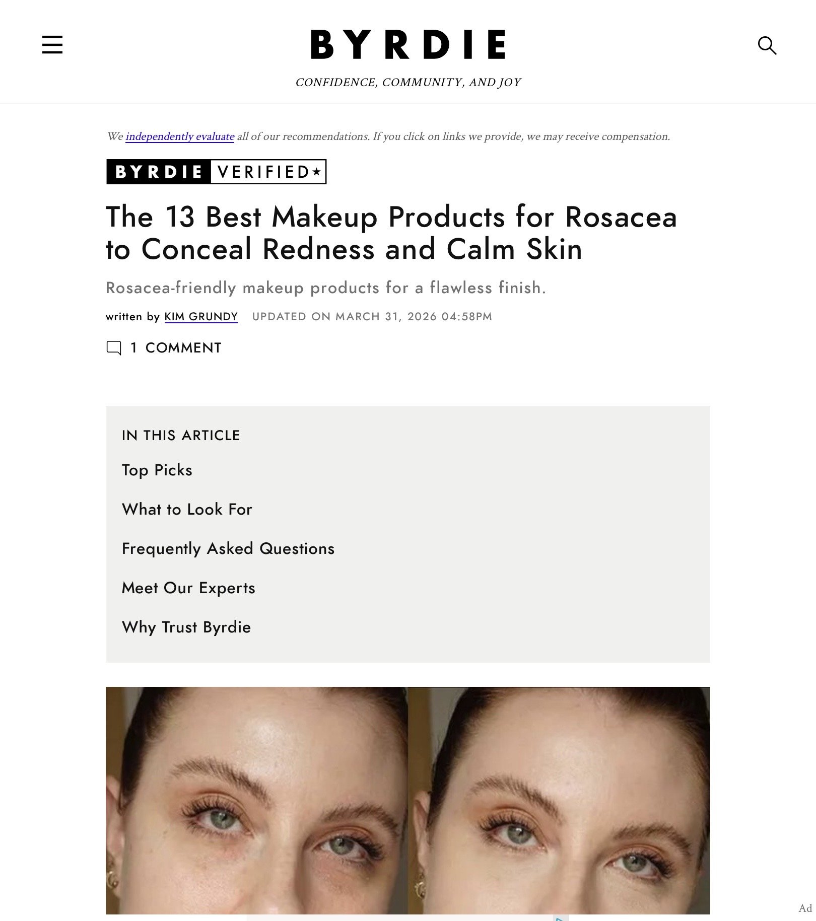 Article feature: The 13 Best Makeup Products For Rosacea To Conceal Redness And Calm Skin” featuring beauty expert Robin Schoen’s suggestions for minimizing redness and enhancing sensitive complexions.