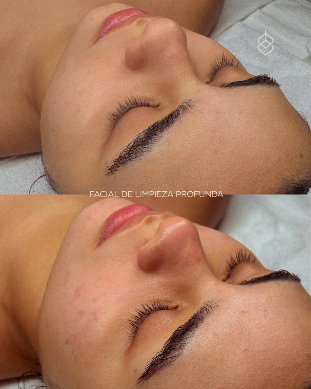 📲 Agenda tu cita via whatsapp o el link de nuestro perfil
📞(664) 547-1459
📍Tijuana, B.C., Plaza Jalisco, La Cacho.

#bareskin #tijuana #spa #tijuanaspa #laserdiodo #powershape #facialpersonalizado #masajescorporales #powershape2