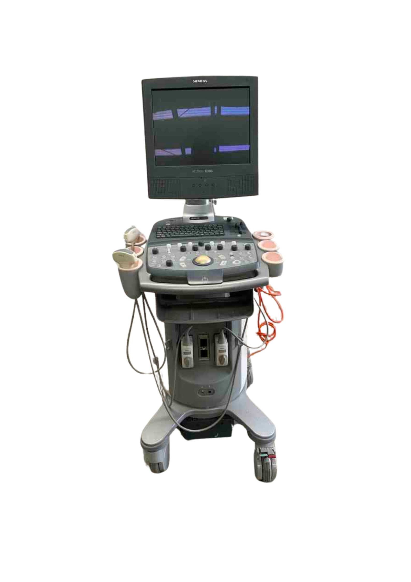 Siemens Acuson X300 Ultrasound - Refurbished