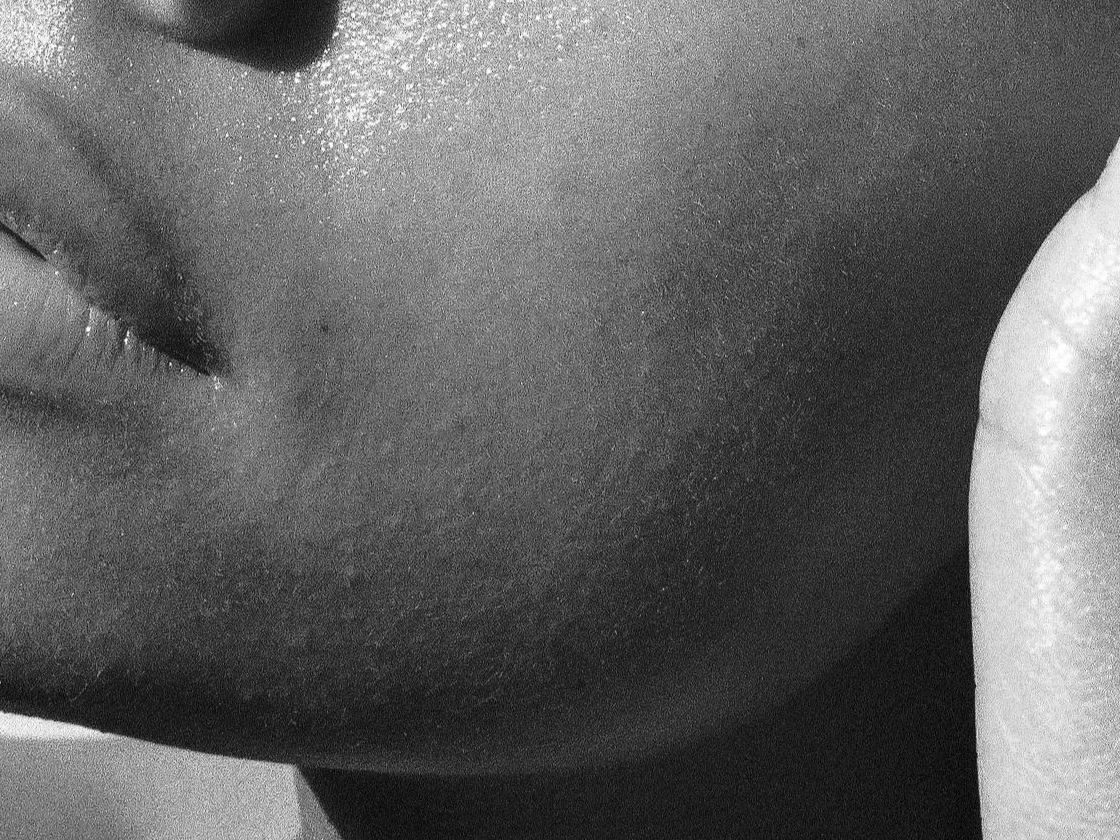 Your Skin Decoded: What Your Breakouts Are Trying To Tell You