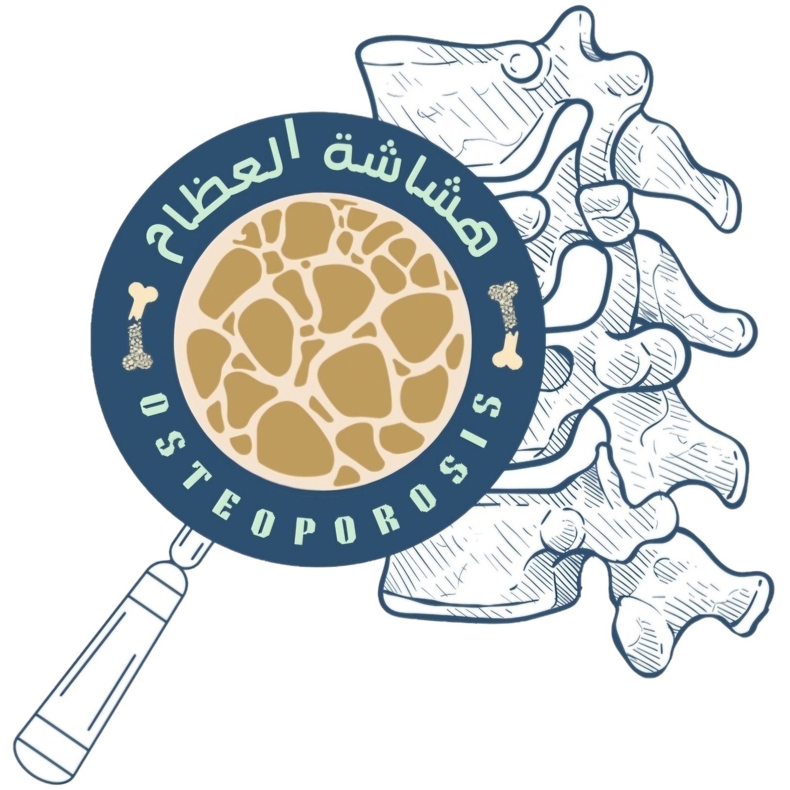 Osteoporosis Campaign