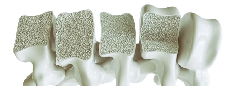 Calcium Alone Isn’t Enough: The 5 Nutrients Your Bones Are Begging For