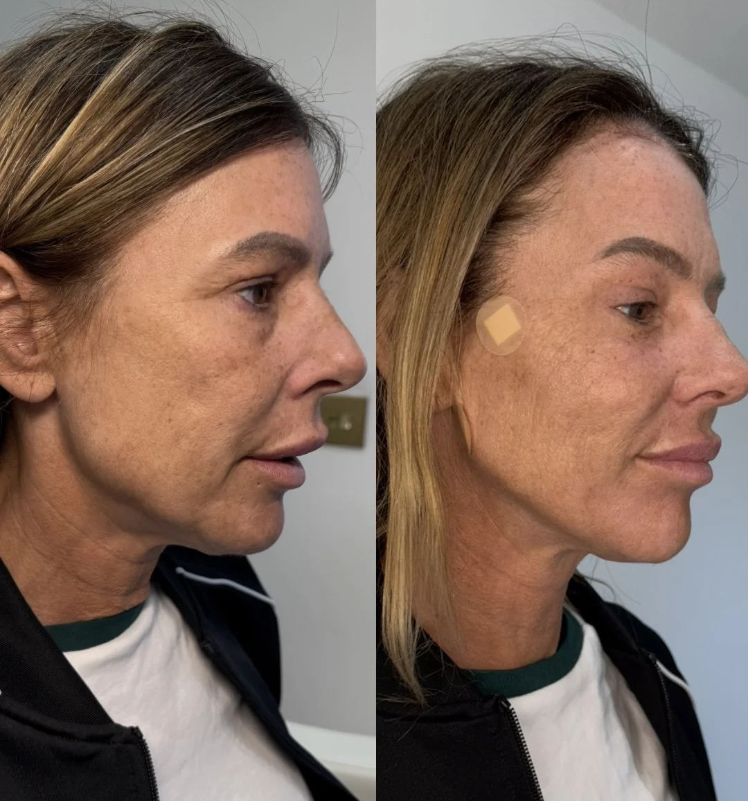 Untitled design - 1.jpeg