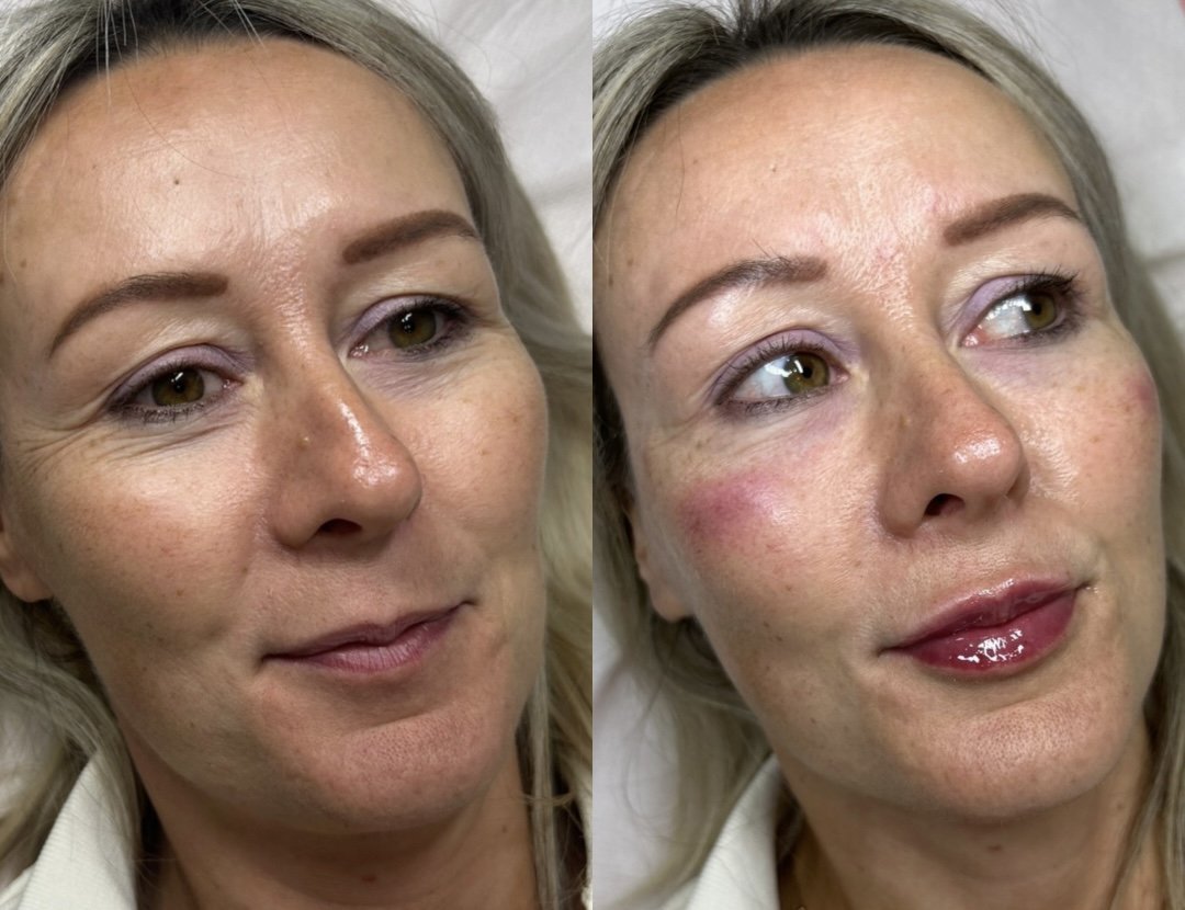 Side-by-side close-up images of a middle-aged woman with blonde hair and light skin. The left shows her without makeup, and the right shows her with makeup, including lipstick and blush.