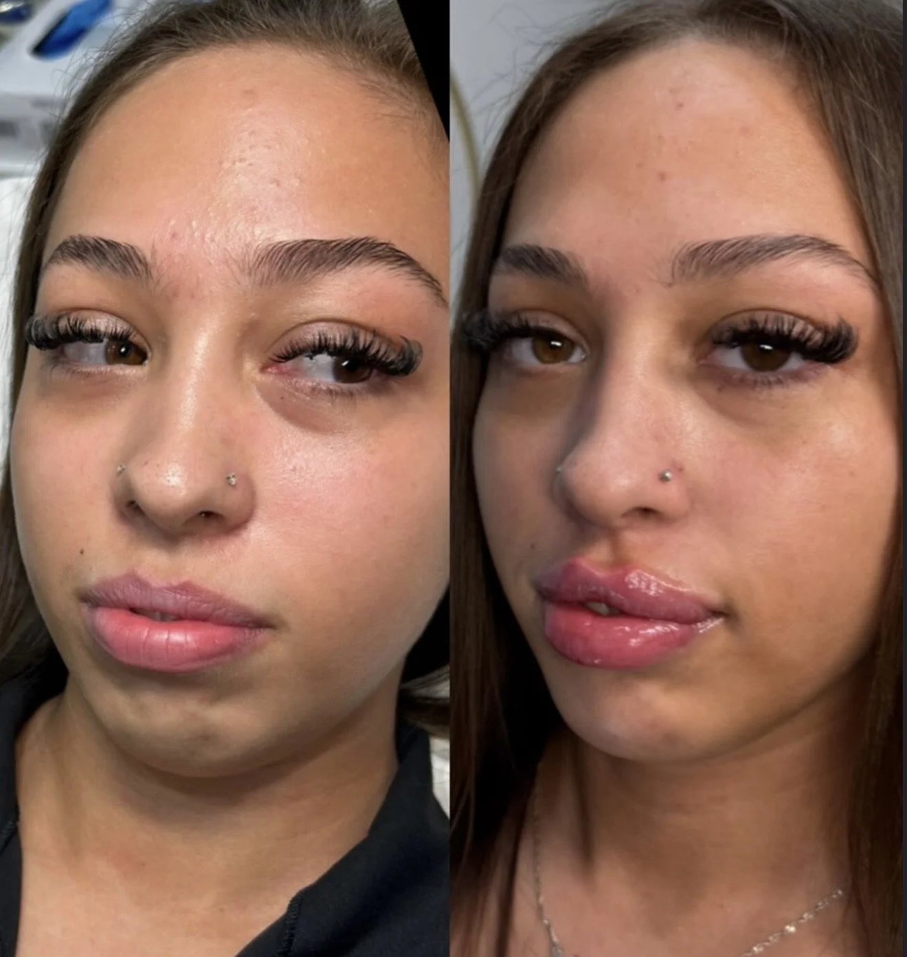 Side-by-side close-up photos of a young woman with brown hair and brown eyes, showing her face with makeup. The left photo features her with eyelash extensions, natural-looking lips, and clear skin. The right photo shows her with glossy lipstick, sli