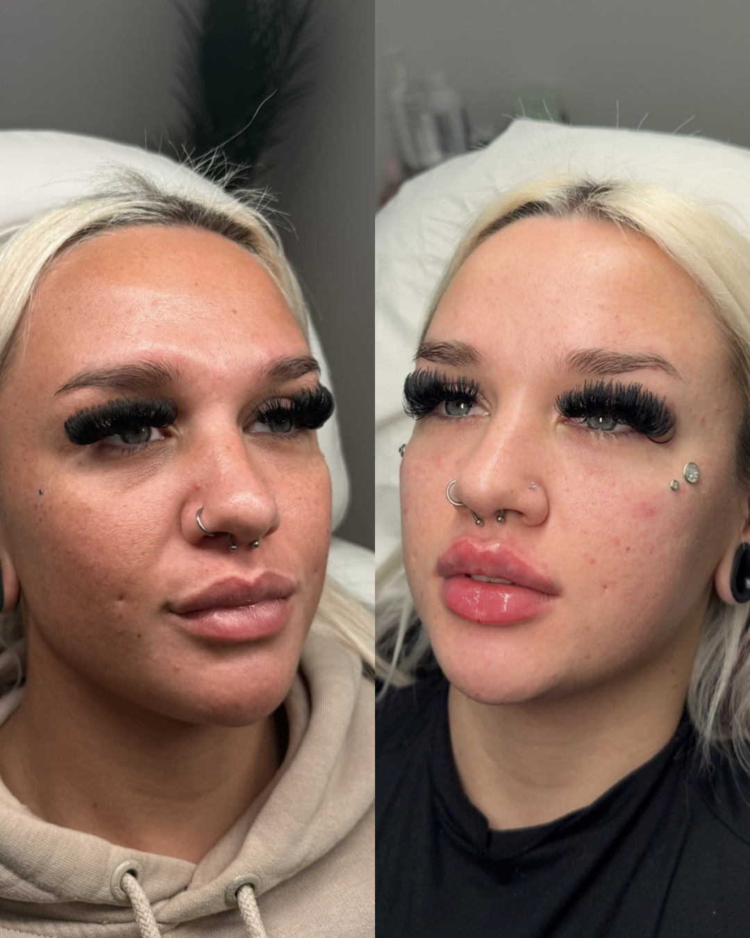 Side-by-side comparison of a woman's face before and after a skincare treatment, showing clearer skin and makeup with thick eyelashes.