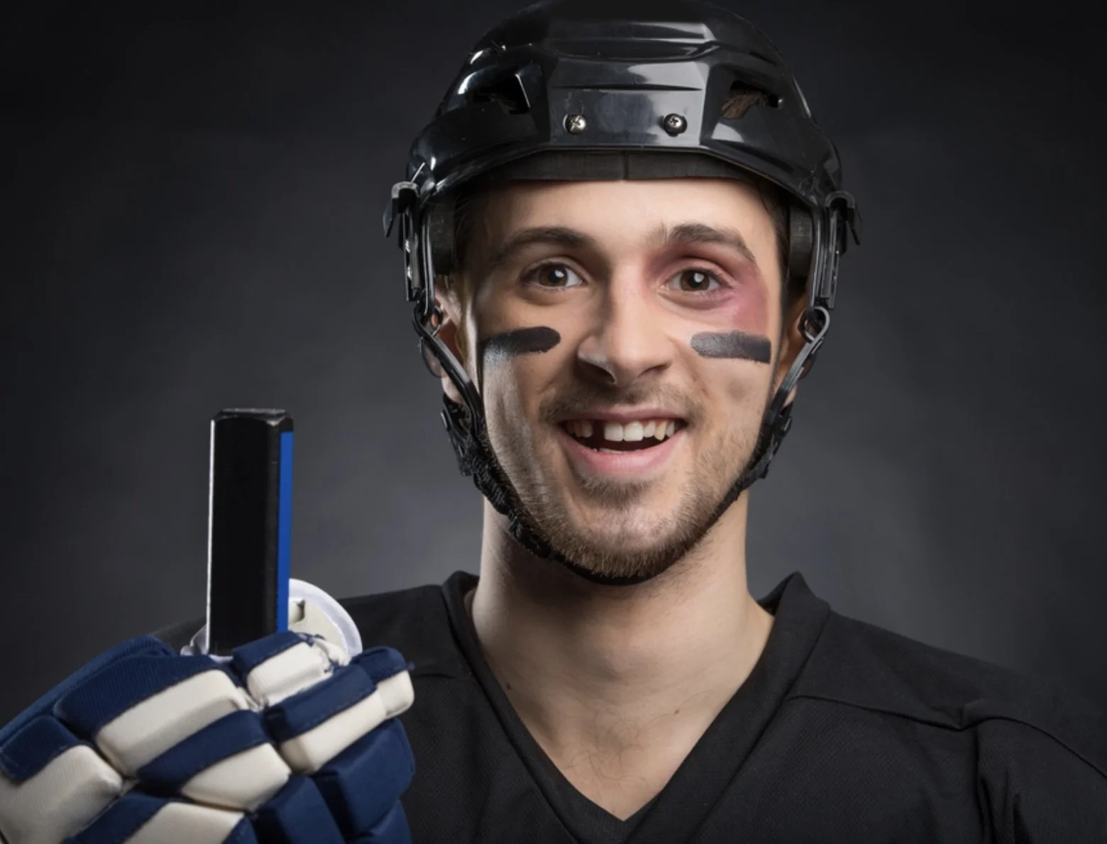 Options for Missing Teeth