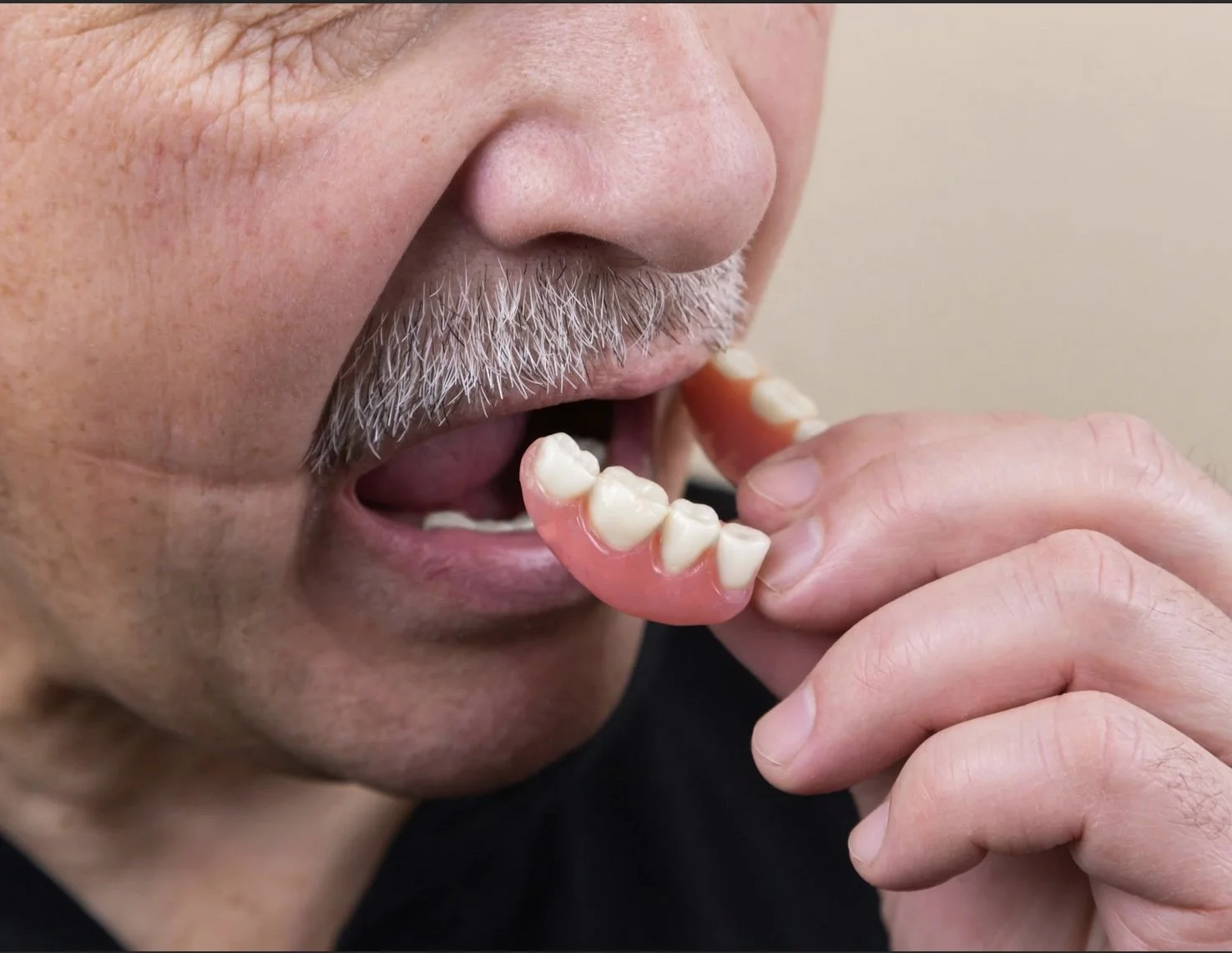 Say Goodbye to Loose, Uncomfortable Dentures