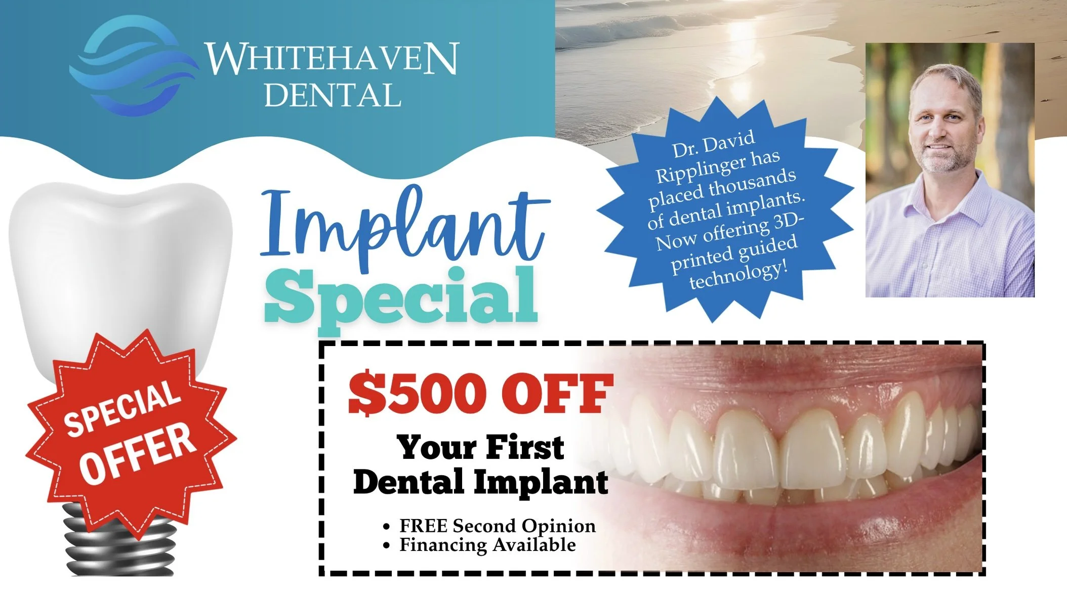 Advertisement for Whitehaven Dental promoting dental implants with a photo of a smiling man, a close-up of teeth and gums, and text highlighting a special offer of $500 off your first dental implant, along with details about free second opinion and financing options.