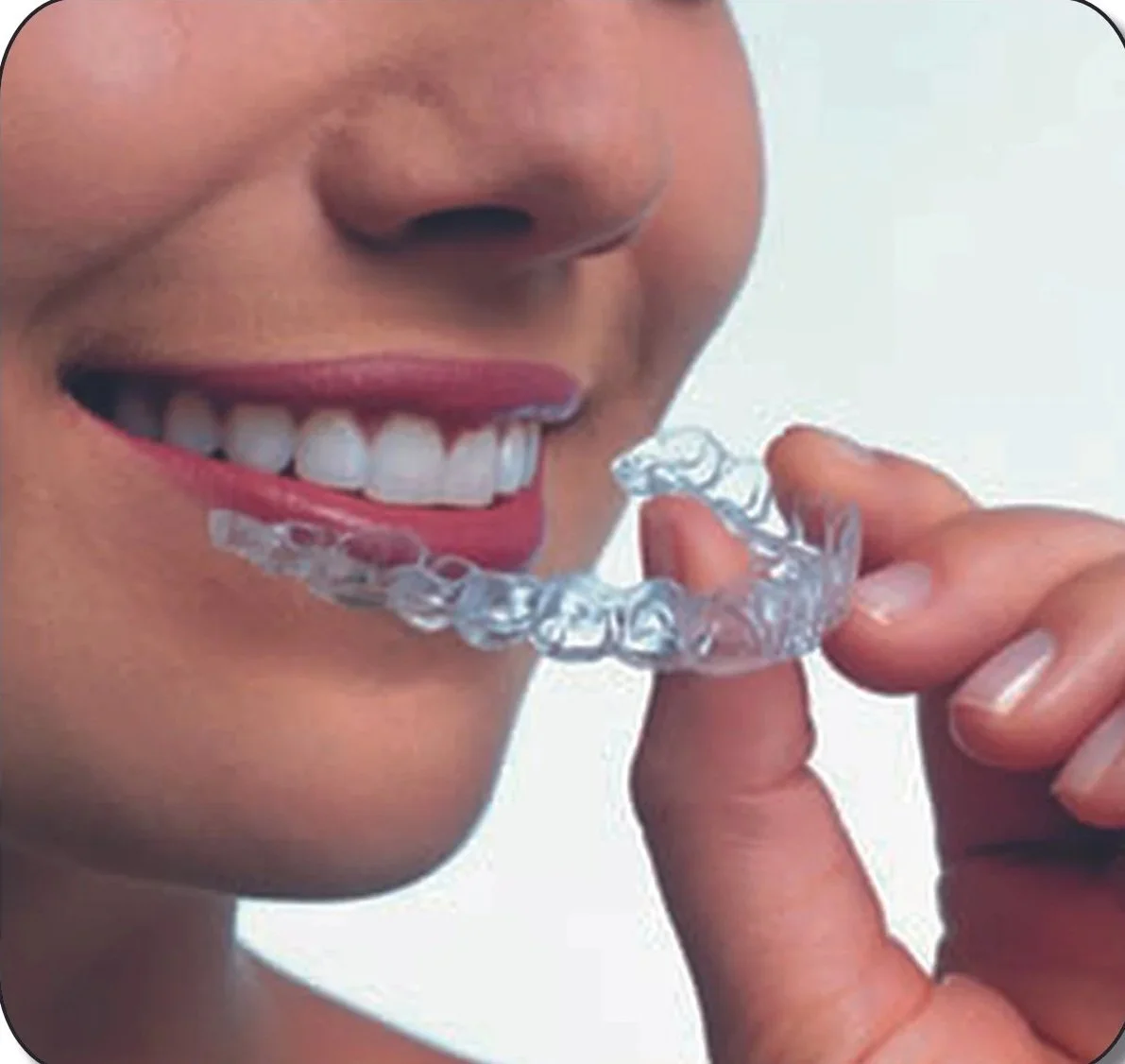 A woman is smiling while holding a clear dental retainer near her mouth.