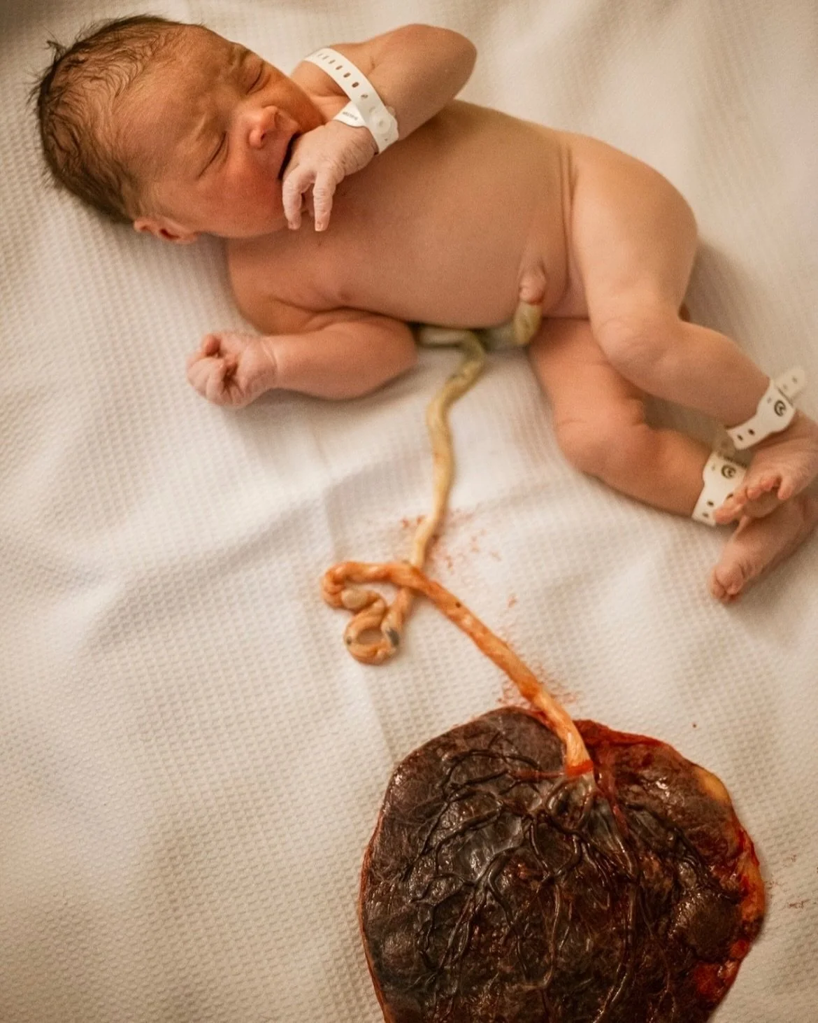 🌿 The Placenta 🌿

Did you know the placenta is like your pepi&rsquo;s home while they&rsquo;re in the womb? 🏠💖
The placenta is an incredible organ that a mama grows only during pregnancy and acts as a life-sustaining connection between mama and p