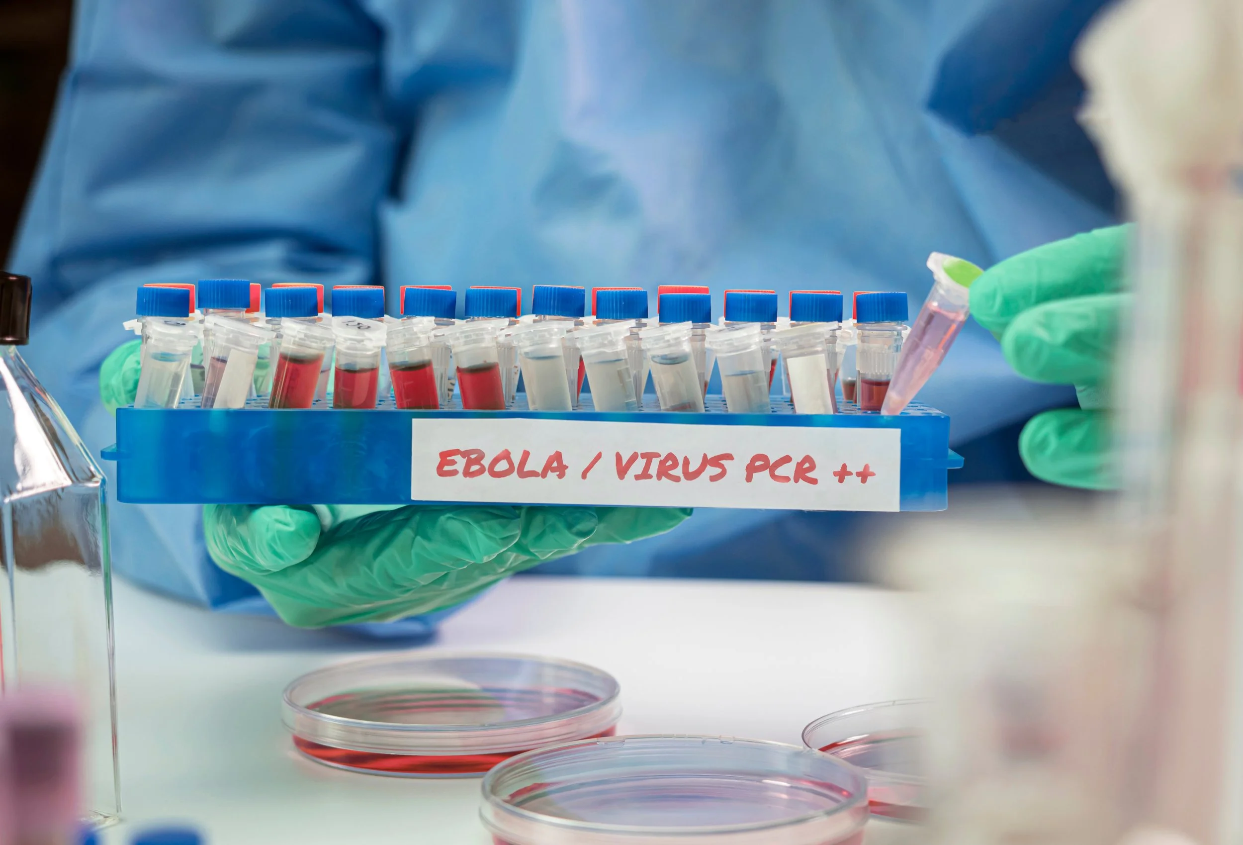 Ebola