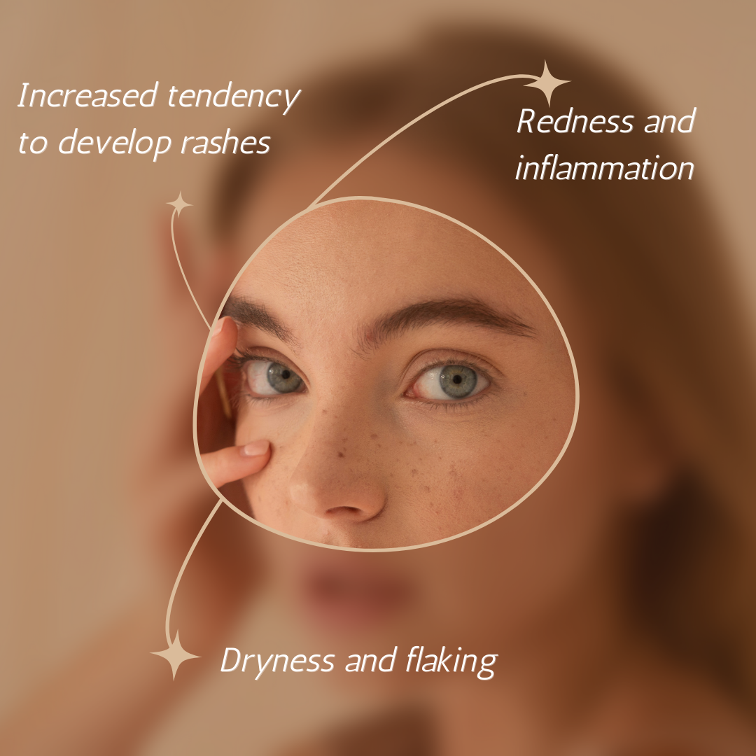 Understanding and Treating Skin Sensitivities