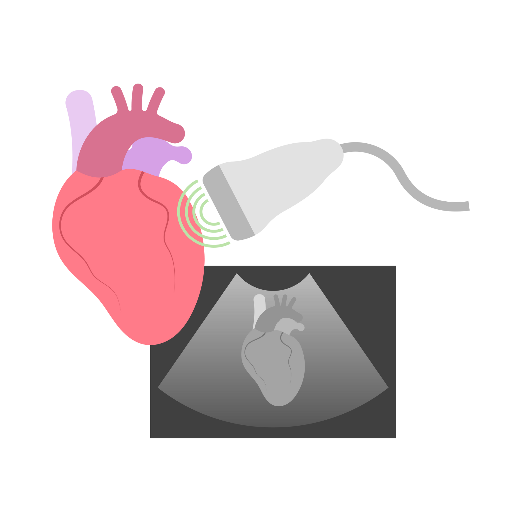 ID SHD Cardiovascular Data Science Lab CarDS Lab Yale id-shd-cardiovascular-data-science-lab-cards-lab-yale