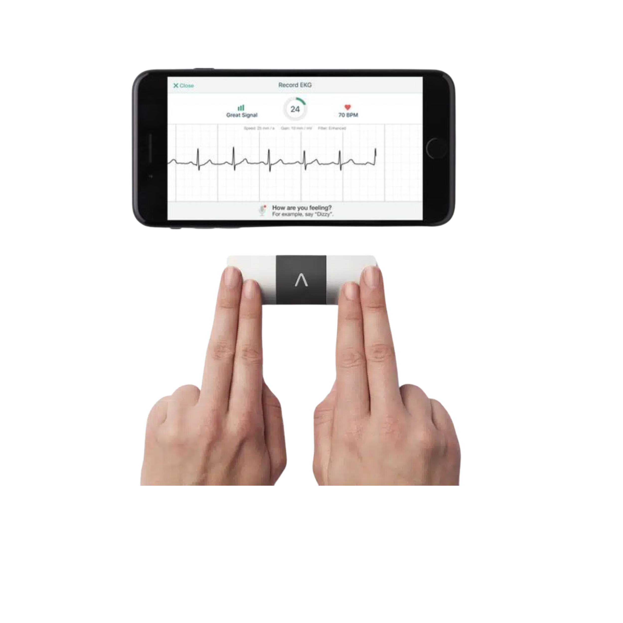 DETECT-AS Diagnostic — Cardiovascular Data Science Lab (CarDS) Lab @ Yale