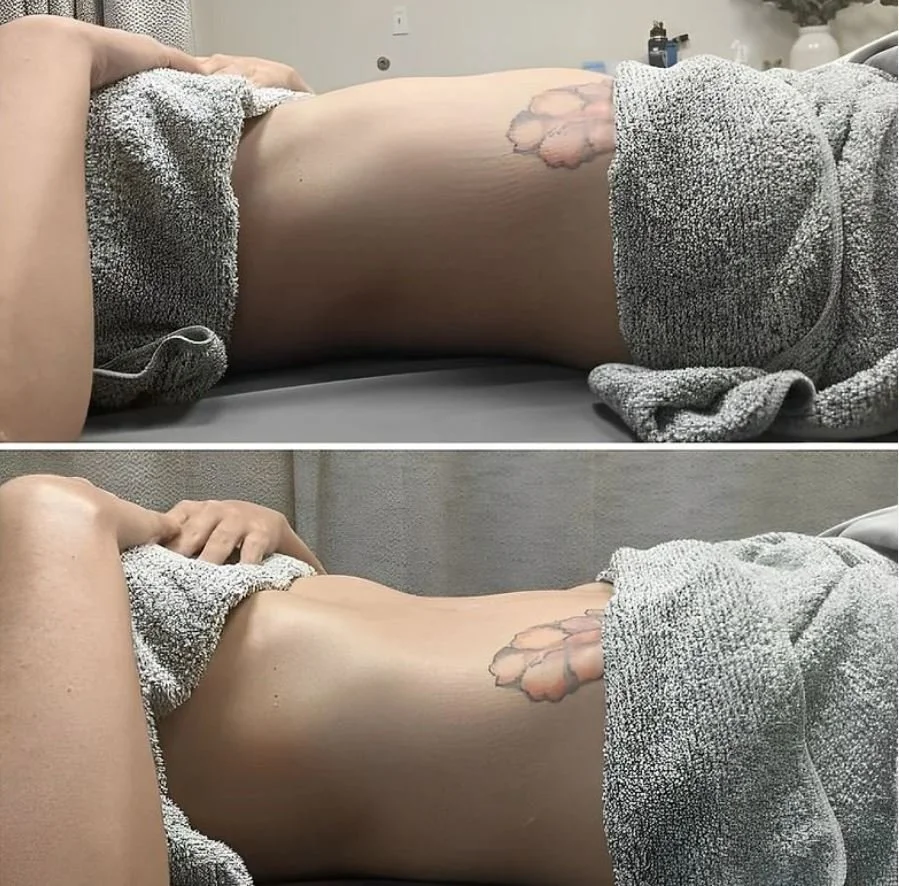 Nectar of Life Sanctuary, Sebastopol California, Lymphatic Drainage Therapy, Results