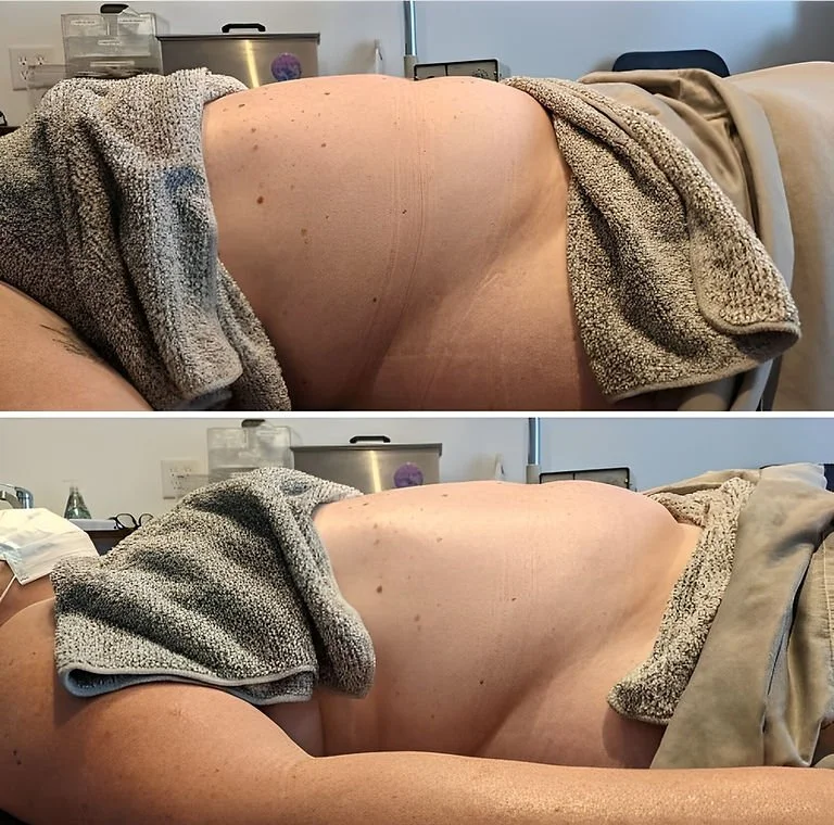 Nectar of Life Sanctuary, Sebastopol California, Lymphatic Drainage Therapy, Results 2