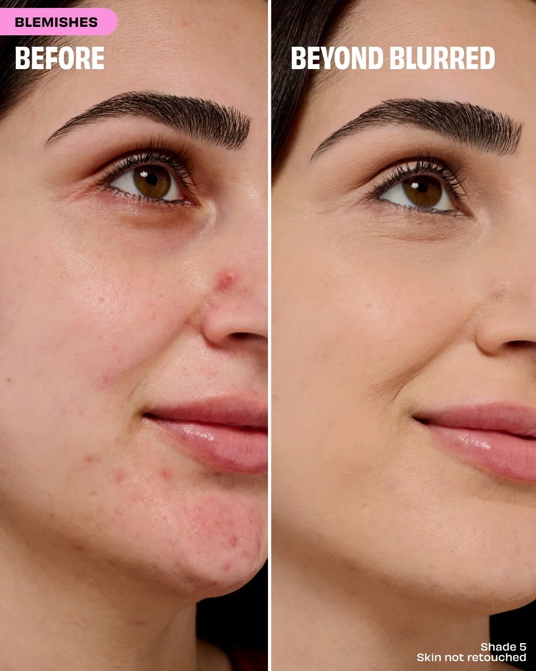 260901_POREfessionalConcealer_Social_BeforeAfter_Shade5.jpg