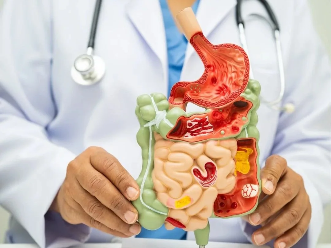 Low Stomach Acid: An Overlooked Cause of Digestive Symptoms